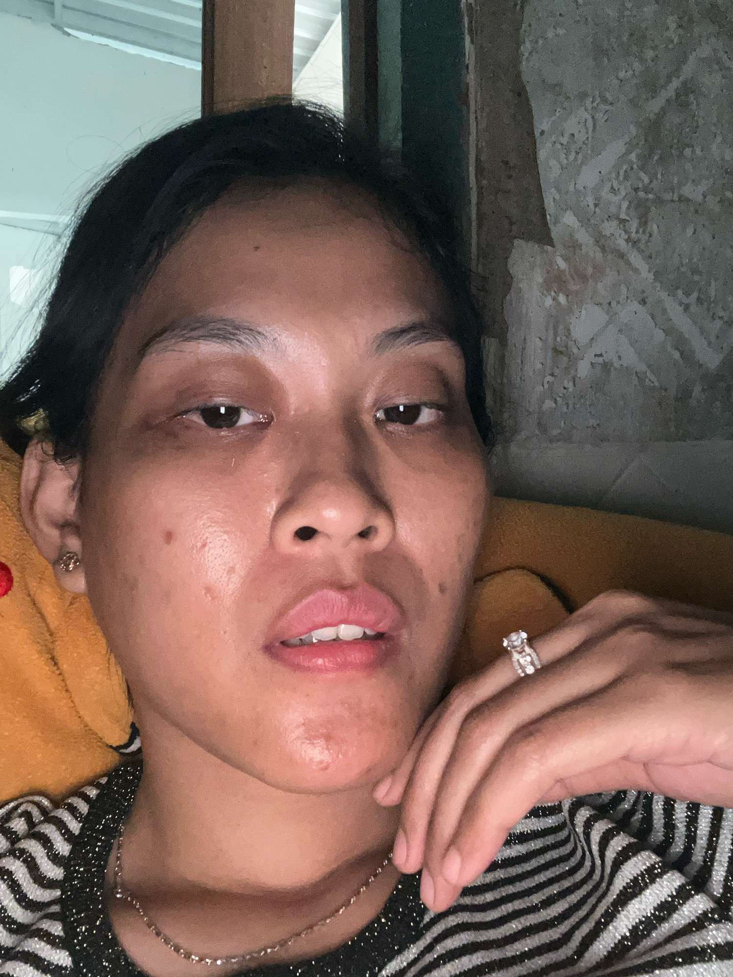 A medium shot captures a woman lying down, looking into the camera. Her head is tilted slightly, with her hair dark and pulled back. She wears a black and white striped shirt and a delicate necklace. A ring with a large stone and smaller stones adorns her right ring finger, which rests on her cheek. Her left hand, adorned with a small stud earring, is visible near her ear. The background consists of an orange textured surface on the left and a wall with a rough, light-colored texture on the right. The lighting is dim, creating shadows on her face. The scene appears to be indoors, likely in a bedroom or living area. The woman's facial features are clear, with noticeable skin texture. The overall impression is one of a candid, personal moment. There is no indication of the specific location within Kecamatan Pati, Indonesia.