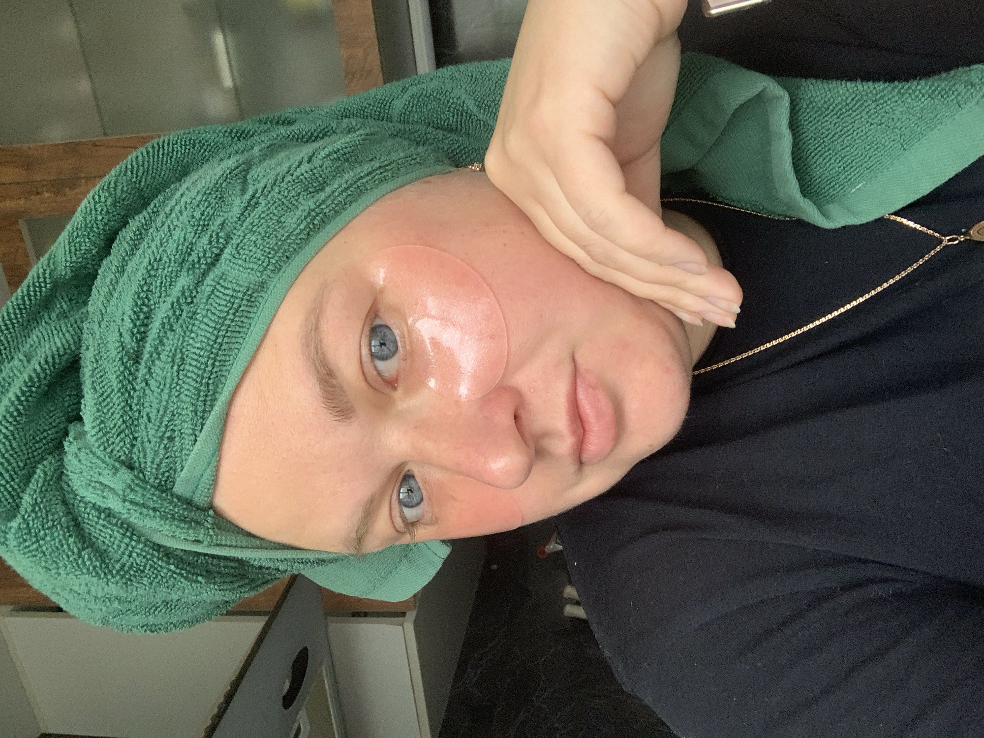 A person with fair skin and blue eyes is visible in a close-up, slightly rotated view. They have a round, pink adhesive patch on their left cheek. A green towel is wrapped around their head. The person's right hand is touching their face. A gold necklace is visible. The person is wearing a black shirt. The background includes elements of what appears to be a domestic setting. There is no information to confirm the location of Chaikovsky, Russia.