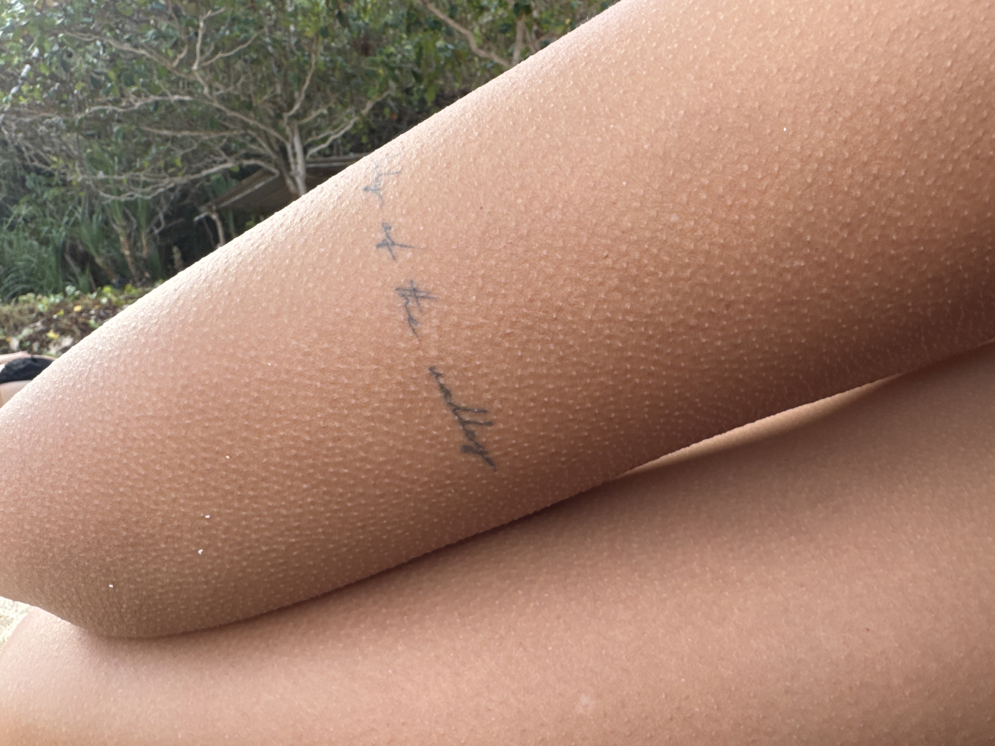 This media file features a close-up of a person's arm covered in goosebumps, suggesting a cool or stimulating environment. A faint, dark tattoo is visible on the arm, appearing to be a short phrase or word written in cursive script. The background is blurred but shows greenery, possibly trees and foliage, hinting at an outdoor setting. The lighting suggests it is daytime, but the specific time is not discernible. The presence of goosebumps and the casual framing of the arm imply a relaxed or candid moment. No specific activity is clearly depicted beyond the person being still. The image composition focuses heavily on the texture of the skin and the tattoo. While the location context is provided as Kuta Selatan, Indonesia, there are no explicit visual cues within the image itself to confirm this location.