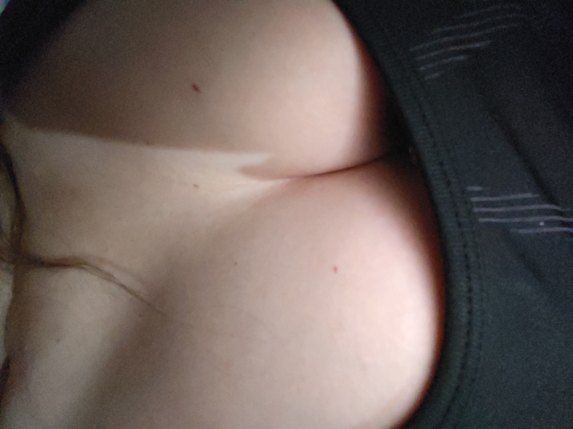 The image displays a close-up view of a person's chest and upper torso, partially obscured by dark fabric. The skin appears light-toned with a visible tan line across the upper chest. There are a few small, reddish marks on the skin, one of which is located near the top left of the chest. The dark fabric on the right side of the image has a textured pattern of horizontal lines. No specific details about the city of Masally, Azerbaijan, can be discerned from this image.