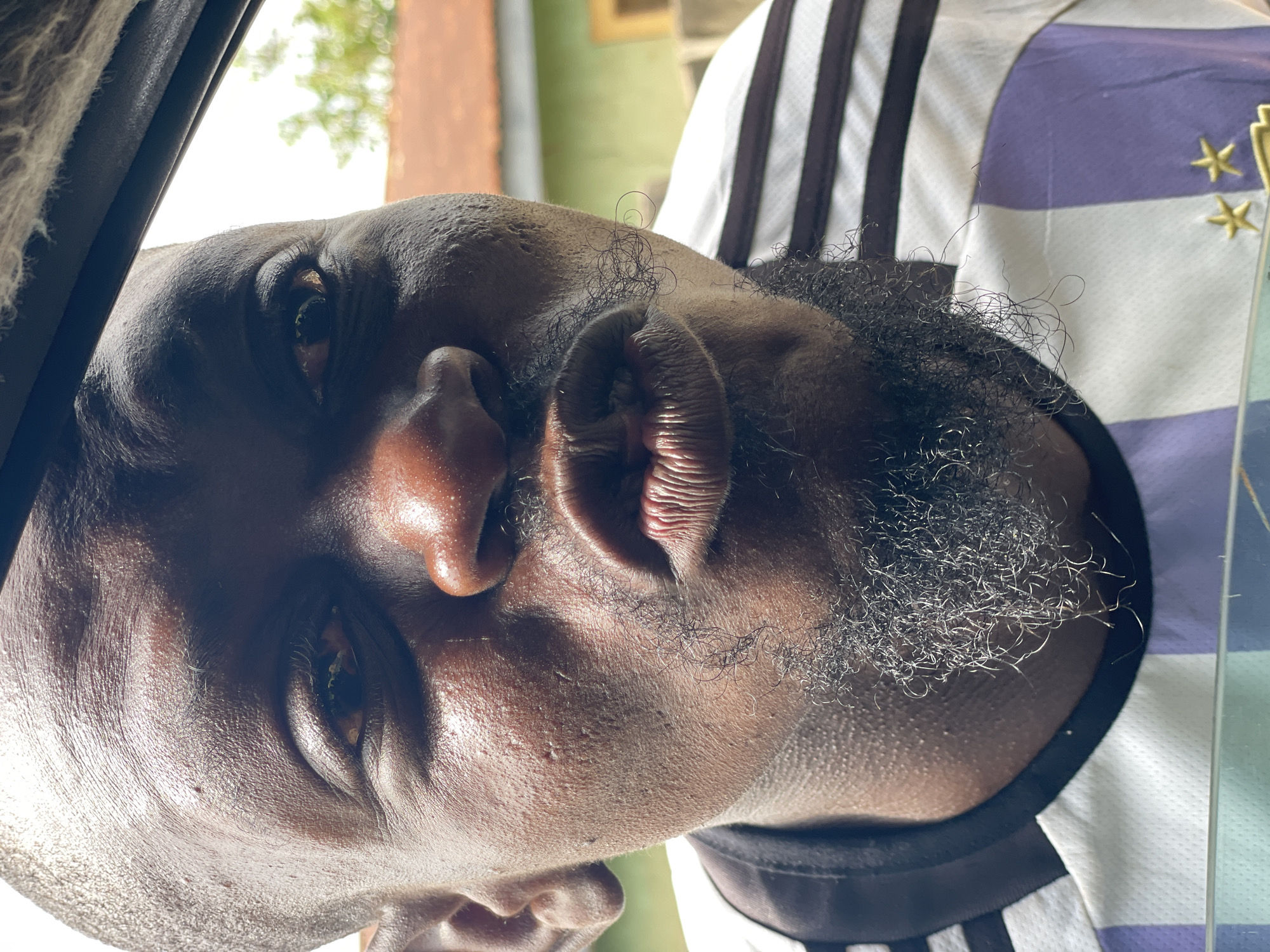 The image is a close-up, eye-level shot of a Black man's face. He is looking directly at the camera with his mouth pursed. His skin appears to be oily and textured, with some visible pores and a light beard. He is wearing a striped athletic jersey with purple and white sections, and a black collar. A blurry background suggests an outdoor environment with hints of a building with a red roof and green siding, possibly in the city of Akwanga, Nigeria. The lighting is strong, casting shadows and highlighting the contours of his face.