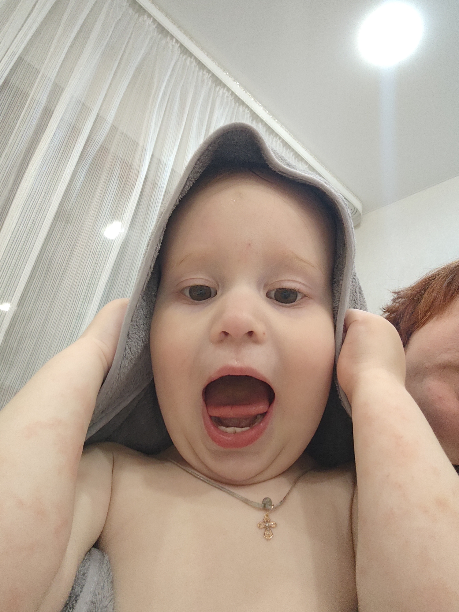 A close-up, upward-angled shot reveals a baby wrapped in a gray hooded towel. The baby has fair skin, brown eyes, and an open mouth. A gold cross necklace is visible around the baby's neck. Patches of redness are apparent on the arms. To the right of the baby, a person with red hair is partially visible. In the background, white curtains are seen along with a ceiling light. The scene appears to be inside a home, possibly in Markovskii, Russia.
