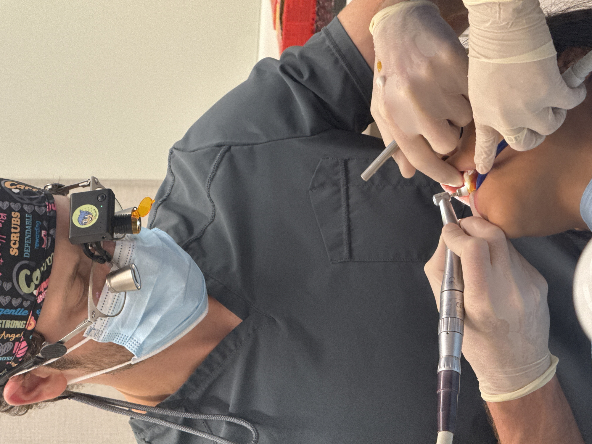 The image shows a close-up view of a dentist performing a dental procedure. The dentist, wearing a surgical mask, loupes with a light, and a scrub cap, is holding a dental drill. Another person, also wearing gloves, is assisting with the procedure, holding a tool near the patient's mouth. The patient is partially visible, with their mouth open. The environment appears to be a dental operatory. The image does not contain any information that would allow for the identification of the city as Barcelona, Spain.