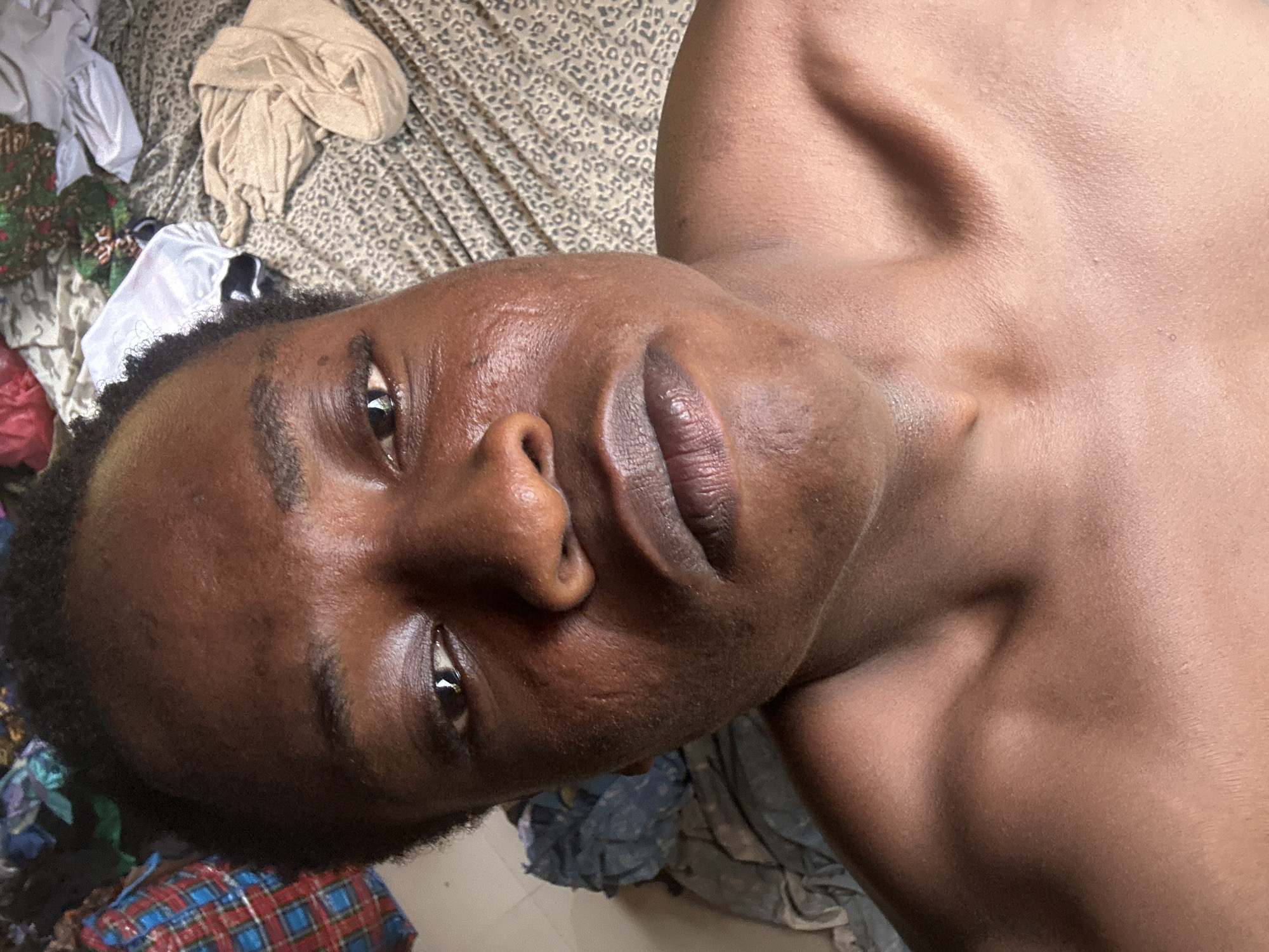 An eye-level, tilted shot captures a person lying down, looking towards the camera. The subject is a dark-skinned individual, appearing male, shirtless, with short dark hair and dark eyes. Their head is positioned towards the left of the frame, with the body extending to the right. The person's expression is neutral to slightly relaxed. Notable features include textured skin, appearing somewhat shiny, and pronounced collarbones on the visible shoulder.
The background shows a messy indoor setting, likely a bedroom. A bed is covered with a light-colored, leopard-print duvet or sheet. Various items of clothing are scattered around the bed and possibly on the floor. These include white fabric, a beige or tan item, and other patterned garments. A piece of red and blue plaid fabric is visible in the bottom left corner. The lighting is soft and even, suggesting an indoor environment without harsh direct light. No text is visible in the image.