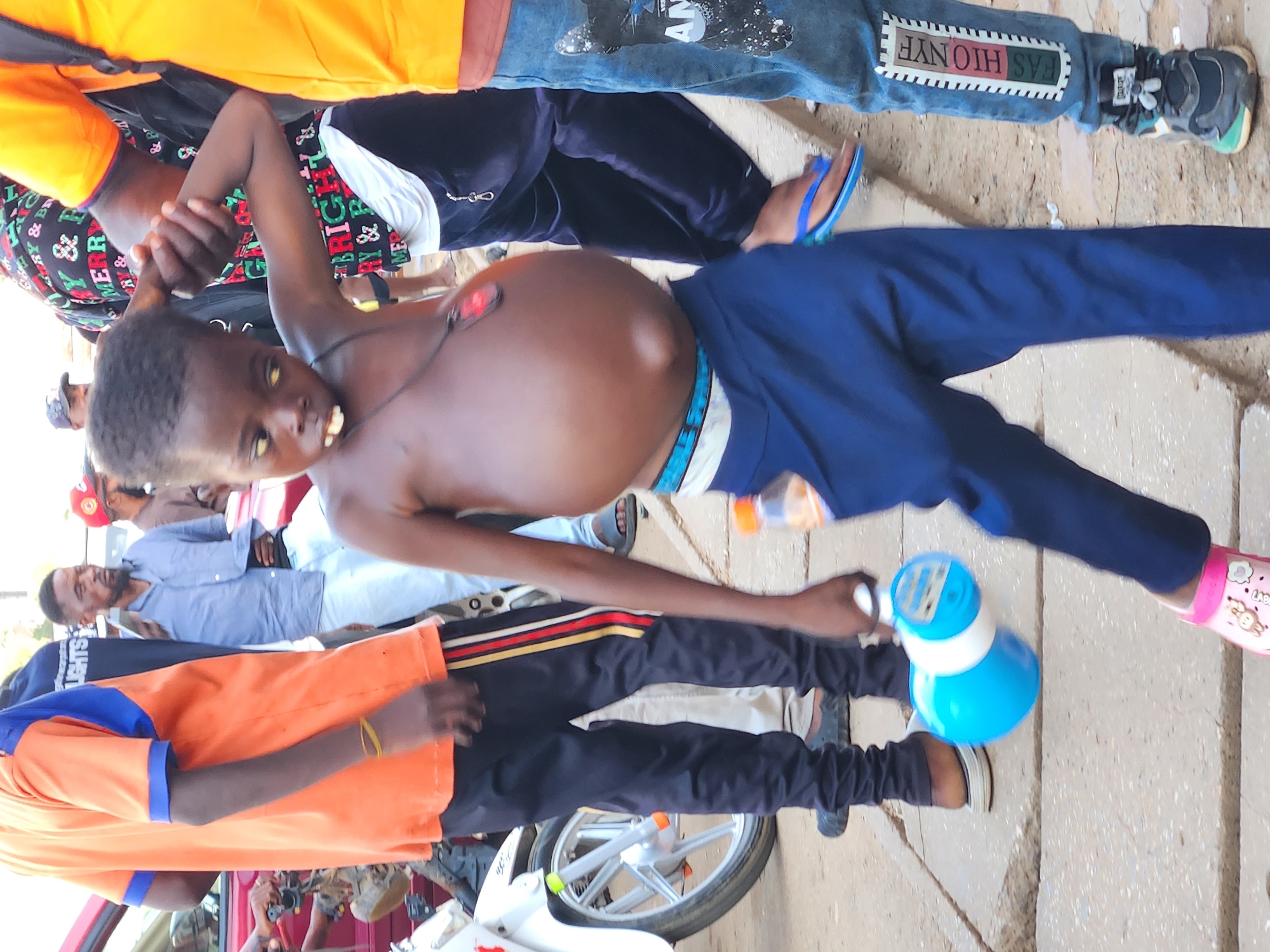 The image shows a young boy with a distended abdomen holding a blue and white toy in his left hand. He is wearing dark blue pants and a necklace. The boy is standing on a paved surface, possibly a sidewalk. Several other people are visible in the background, including adults wearing t-shirts and pants. One adult is wearing an orange shirt and black pants with red, yellow, and white stripes. Another person is wearing a blue shirt and light-colored pants. A red car is partially visible on the left side of the image, and a white motorcycle is parked behind the boy on the left. The environment appears to be outdoors in an urban setting.