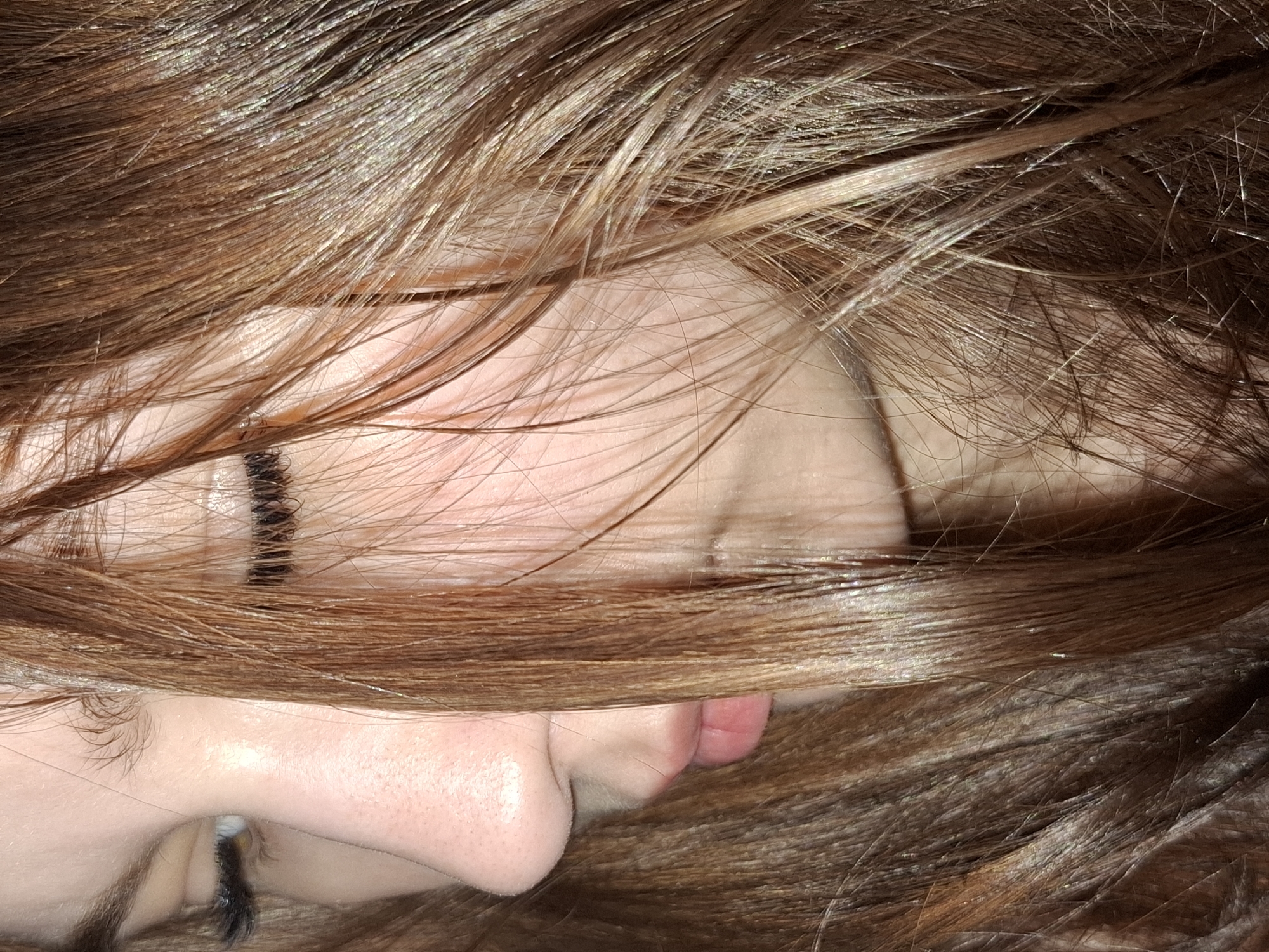The image shows a close-up, rotated view of a person's face partially obscured by brown hair. Visible features include the nose, lips, cheek, and eye. A line is drawn on the forehead. The location is not discernible from the image.