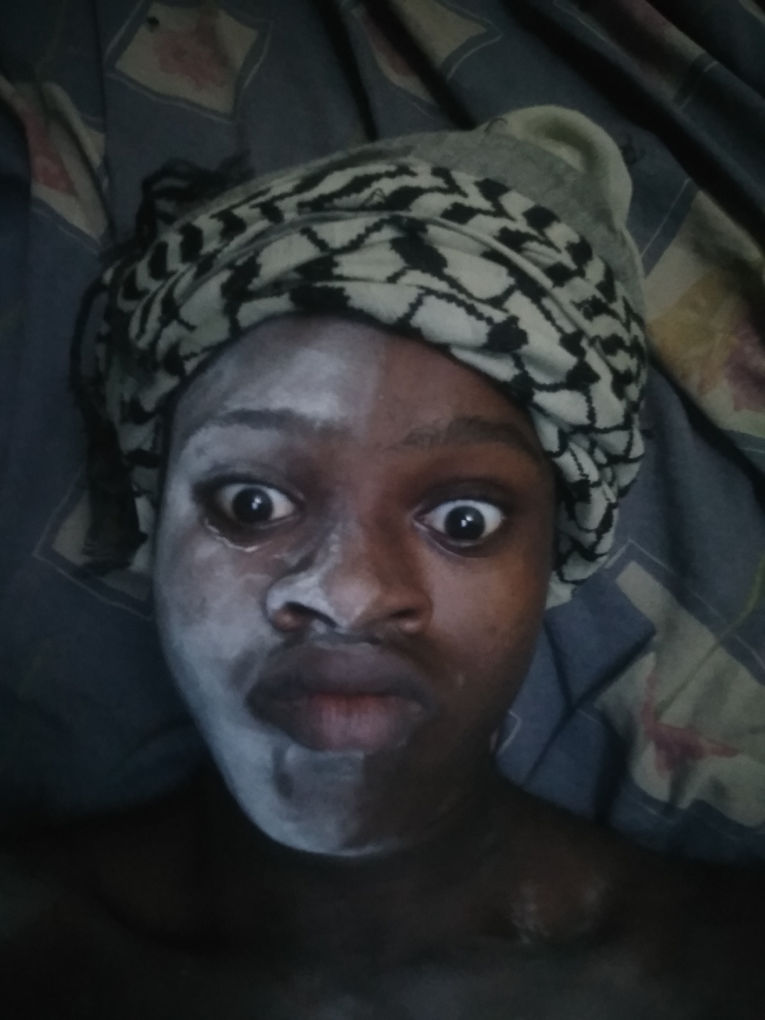 A close-up photograph features a person's face, partially covered with a white substance on the left side, set against a background of a blue and patterned bedsheet. The person is wearing a head covering with a black and white design. The location is inferred to be Shangisha, Nigeria.