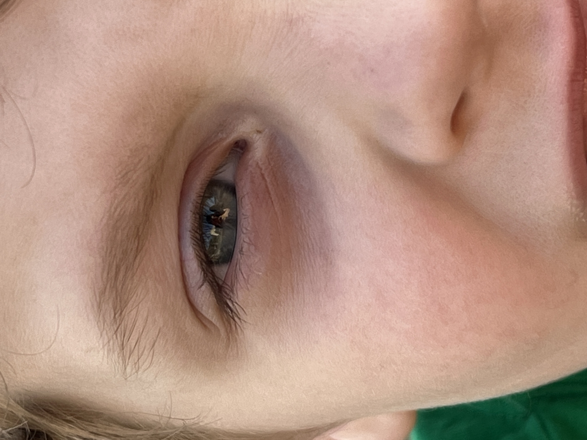 A close-up image depicts the right side of a child's face, focusing on the eye and surrounding skin. The skin is fair with visible textures and subtle variations in tone. Eyelashes are clearly visible, and the eye reflects a complex scene, potentially showing multiple figures and buildings. The reflection is too small to identify specific individuals, structures, or activities. The child's nose and part of their lips are also visible. The environment appears to be indoors, given the lighting and the presence of the reflected image. There is no discernible information related to the city of Noviy, Russia, other than what may be contained in the reflection in the eye. The scene does not provide definitive proof to support a conclusion about any location in the city of Noviy, Russia.