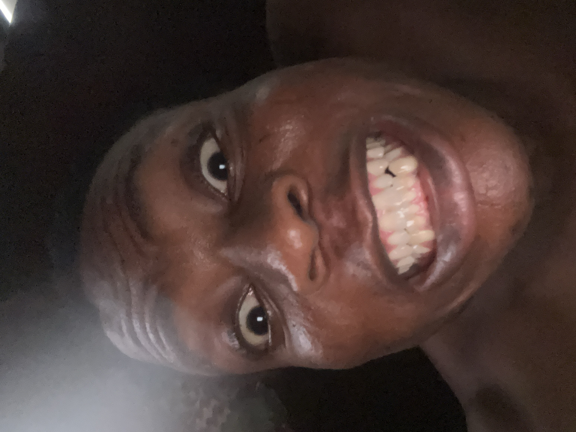 A close-up, tilted, low-angle shot shows a person with dark skin, bared teeth, and visible gums. The person is facing the camera with their head tilted to the right. The background is dark and out of focus. The image does not provide information about location.