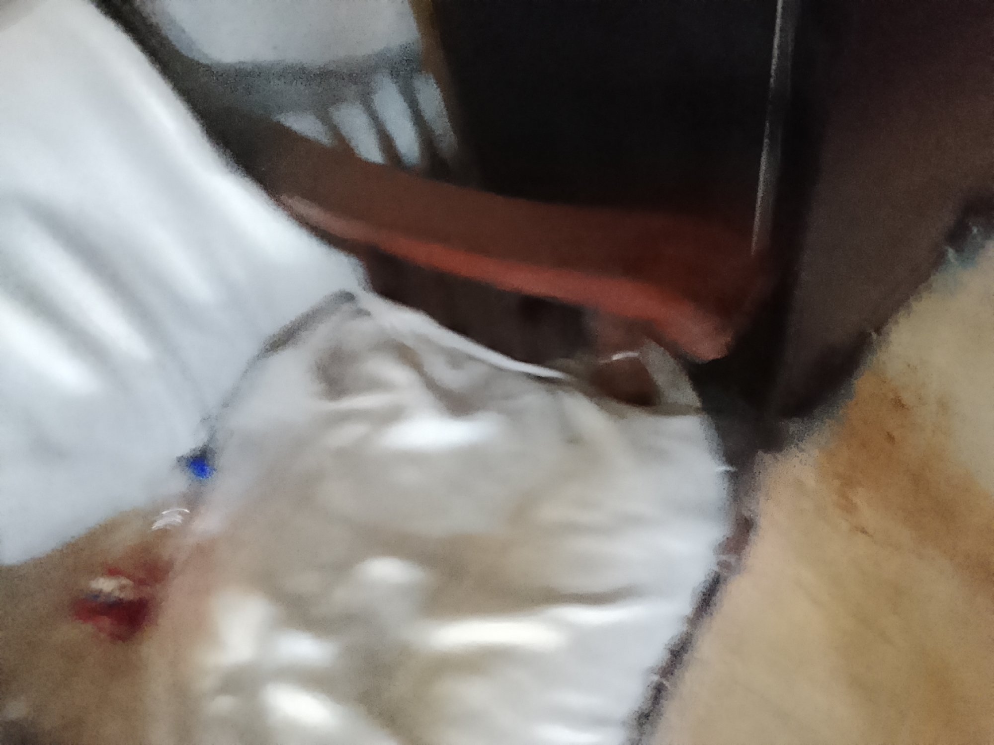 The image appears to show a medical scene. A person is lying in a bed with white sheets. A medical device, possibly an IV, is visible on the person's arm. A dark-colored object, possibly a piece of furniture, is positioned beside the bed. Location information is unavailable.