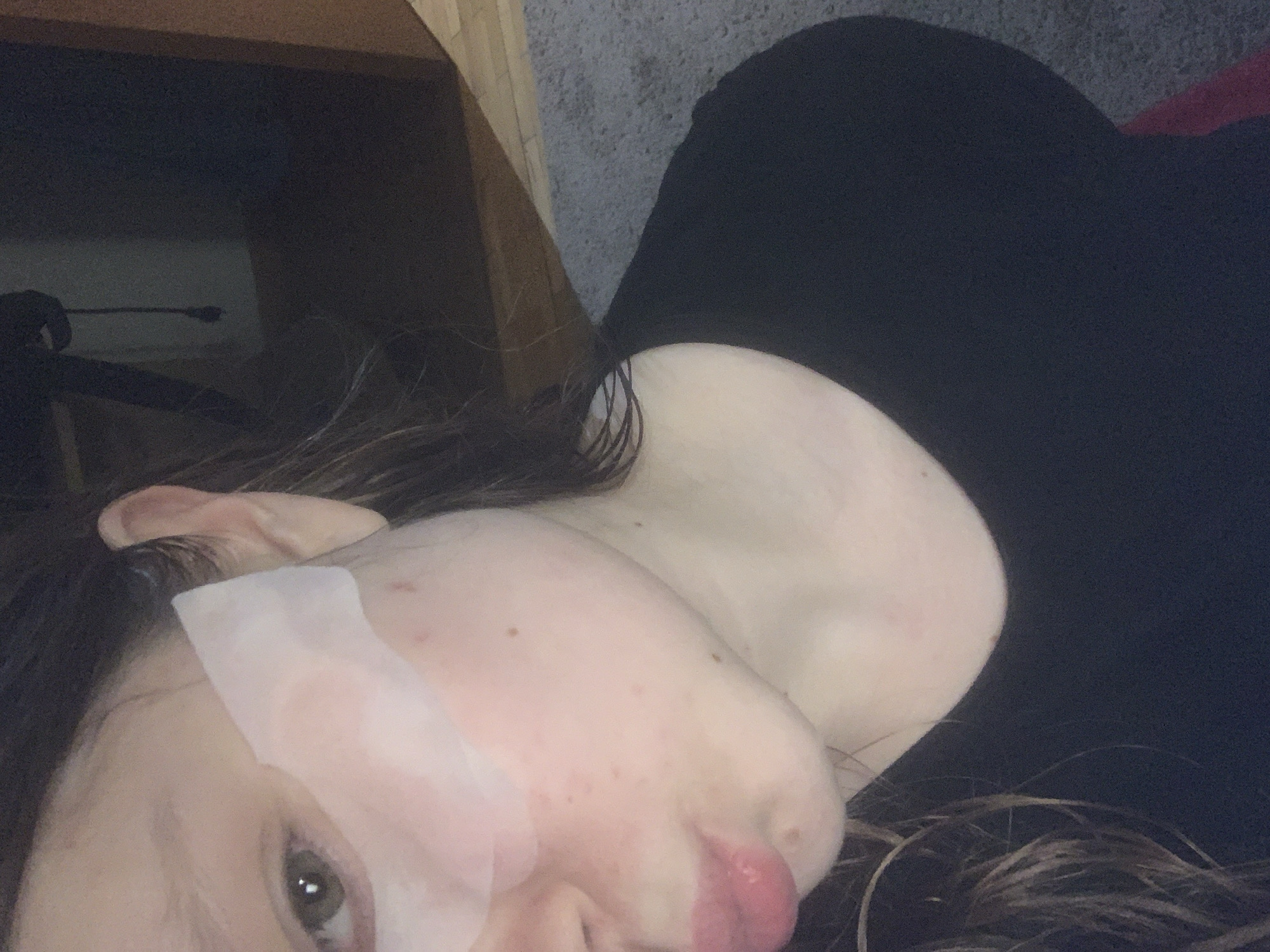 A close-up, angled shot shows a person lying down. A white bandage is adhered to the forehead above their eye. The person has fair skin and dark hair. Their lips appear swollen. The background includes a dark, solid color material and a wooden edge of a furniture piece. A desk chair is partially visible in the upper left corner. The location of this image is not within Sinyavino, Russia.