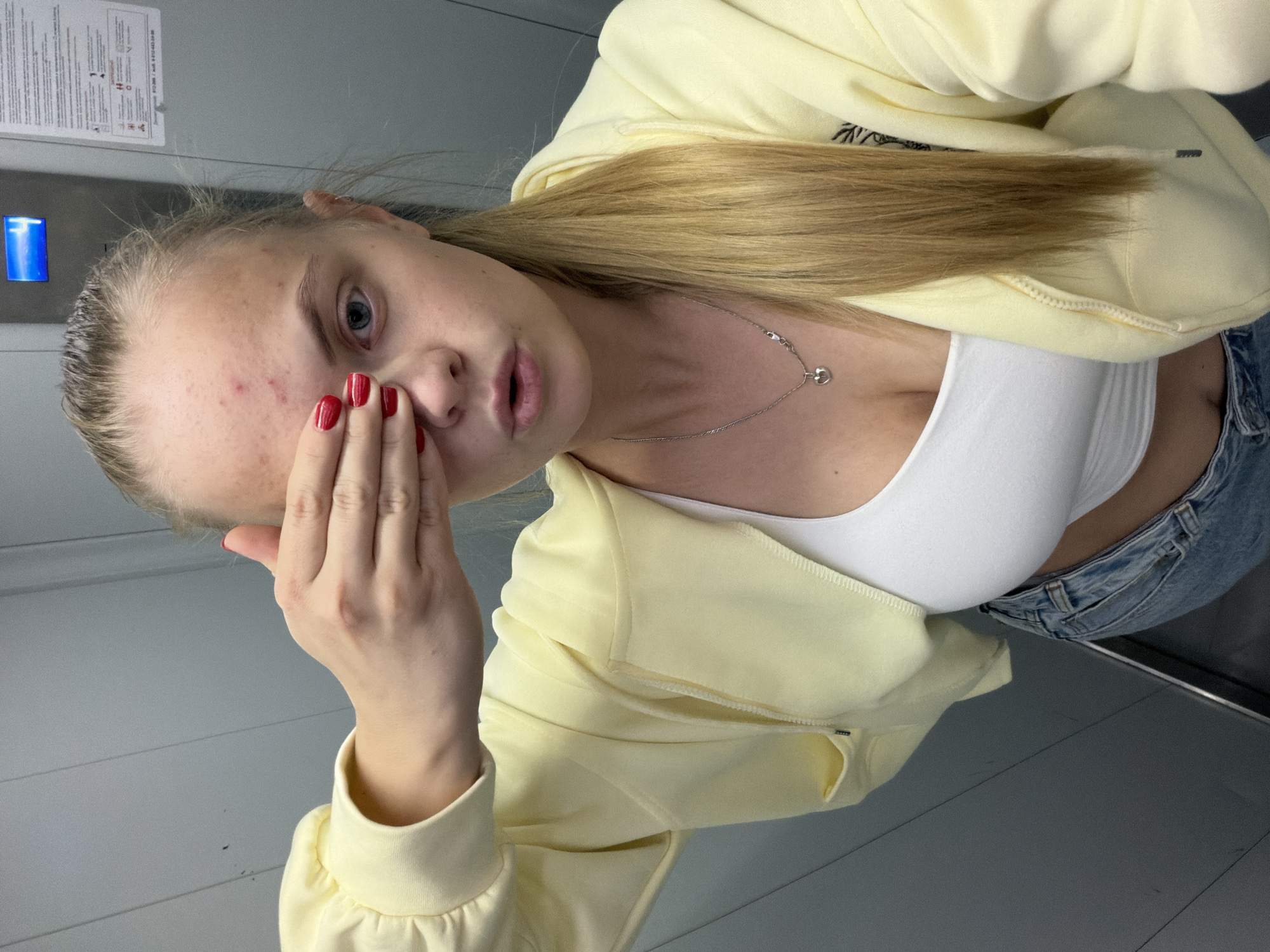 A young woman with blonde hair is in an elevator. She is wearing a white top under a light yellow zip-up hoodie and blue jeans. She has her hand up to her face, touching her forehead, which has some red blemishes. She is wearing red nail polish. A silver necklace is visible around her neck. The elevator has grey walls, and a sign and a blue light are visible on the wall behind her. The location is inferred to be Izhevsk, Russia, but there's nothing in the image to confirm this location.