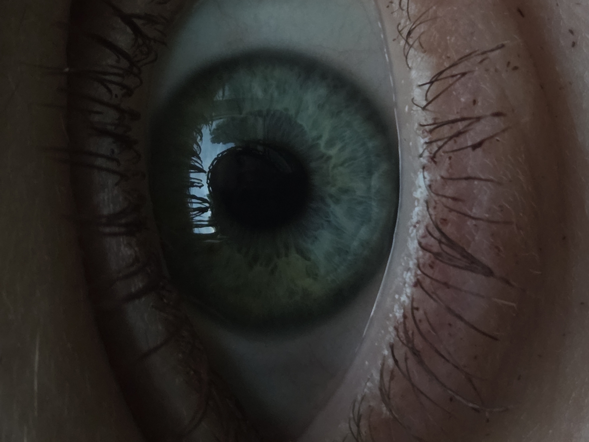 An extreme close-up of a human eye shows the iris, pupil, eyelashes, and surrounding skin. The iris is a vibrant blue-green with intricate patterns and flecks of color. The pupil is a dark, circular opening at the center of the iris. Eyelashes frame the top and bottom of the eye. The skin surrounding the eye appears textured and shows pores. Reflections of what appear to be trees and possibly a building are visible in the pupil.