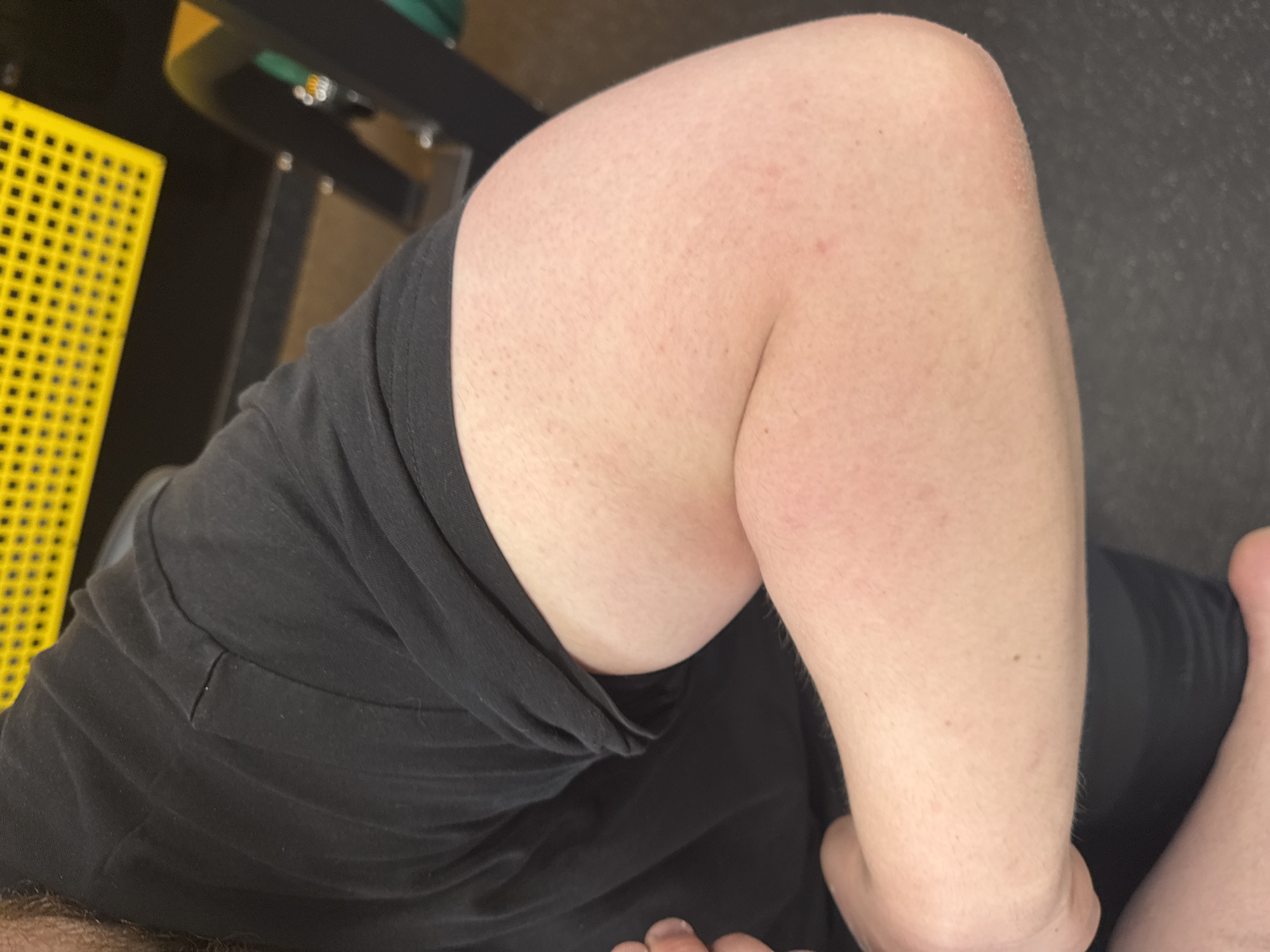 A close-up, chest-level shot shows the upper torso and right arm of a fair-skinned individual, flexed at the elbow, revealing a bicep. The person wears a black, short-sleeved t-shirt. The skin on the arm exhibits faint redness in localized areas and contains numerous small pores. A few small, dark dermatological marks are present on the forearm. In the background, an out-of-focus bright yellow gridded or perforated surface occupies the upper left quadrant. Adjacent to it on the right are indistinct dark metallic structures, characteristic of gym equipment. The lower portion of the image displays a dark, possibly rubberized floor surface. The scene is an indoor environment in Unknown, Unknown.