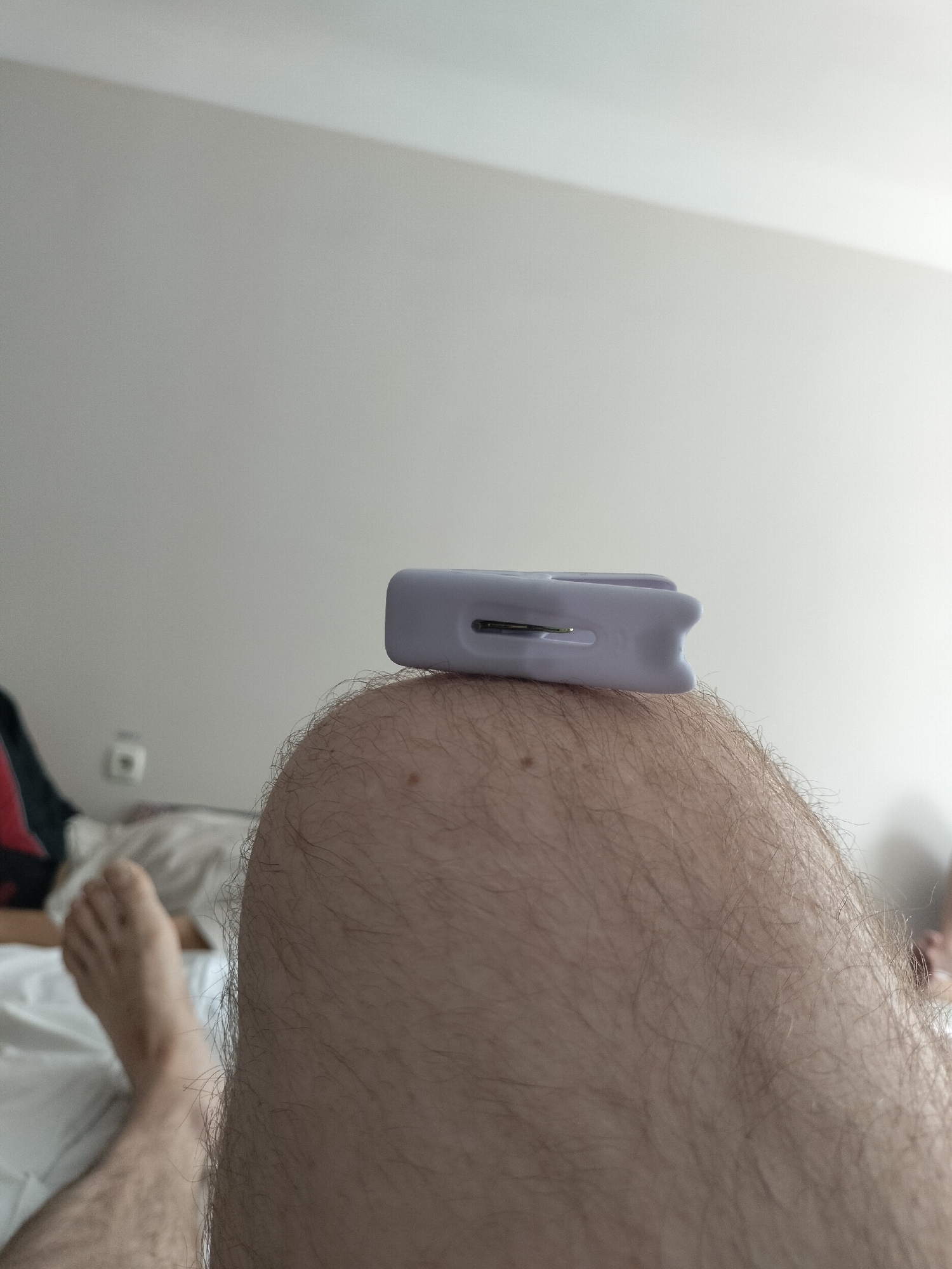 The image shows a close-up view of a person's hairy leg with a light purple plastic object, possibly a clothespin or a cable tie, resting on top of the knee. The background consists of a plain, light-colored wall and a bed with white sheets. In the distance, a power outlet is visible on the wall. The lighting suggests an indoor setting, likely a bedroom. The image does not provide any information about the location in Chernihiv, Ukraine.