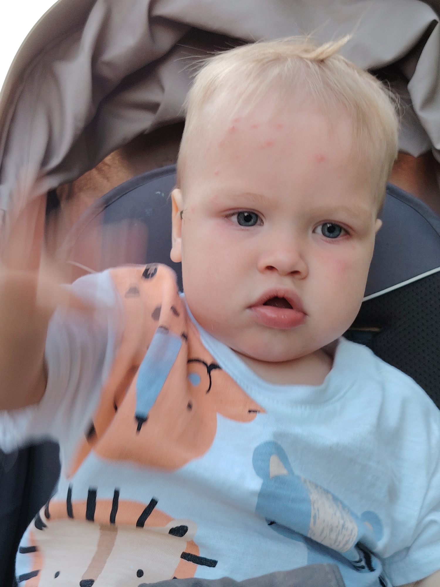 A close-up shot depicts a fair-skinned toddler with blond hair and blue eyes. The child is wearing a white t-shirt adorned with an orange animal print, which includes black stripes. Red spots are visible on the toddler's forehead and cheeks. The child is seated in a gray stroller. The location is not discernible from the image.