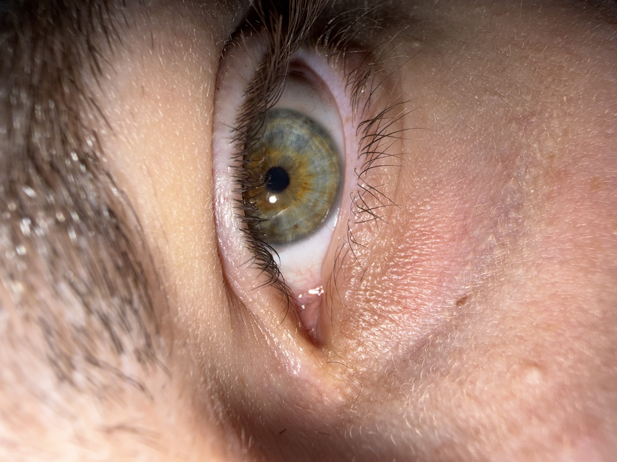 A close-up image shows a human eye with a light hazel iris that transitions from green to yellow around the pupil. Dark brown eyelashes surround the eye. The skin around the eye is light, with a visible mole. The image shows the area near the tear duct, which appears slightly moist. The surrounding skin shows fine lines and pores. There's no indication of the city of Stara Zagora, Bulgaria, or its inclusion in the image.