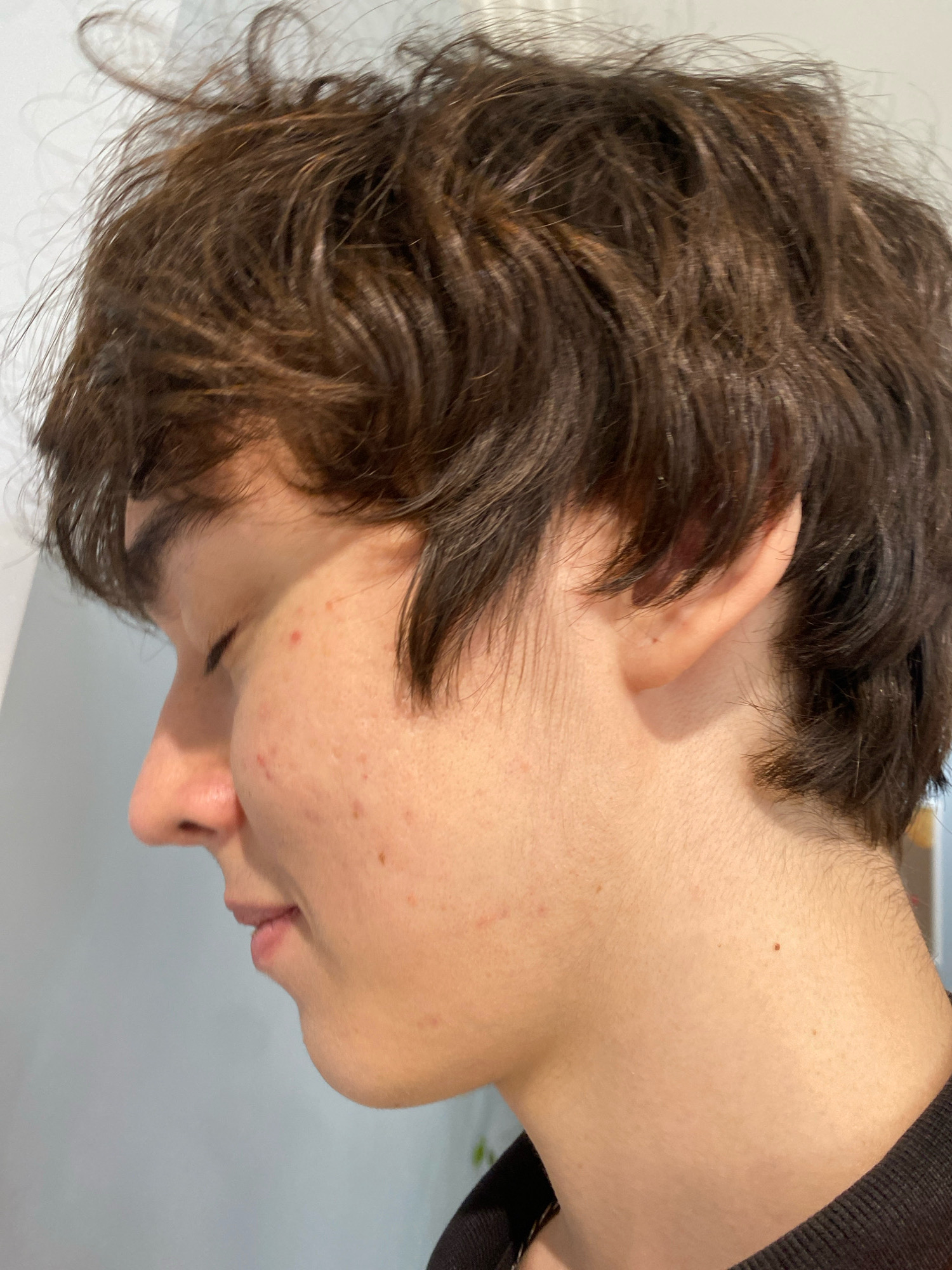 The image is a close-up, profile view of a young person with brown, slightly messy hair. The person's eyes are closed, and their face is turned slightly to the left. There are several small blemishes or pimples visible on their cheek. The background is a plain, light-colored wall. The image does not contain any information that would allow for the determination of its location in Astana, Kazakhstan, or any specific environmental context.