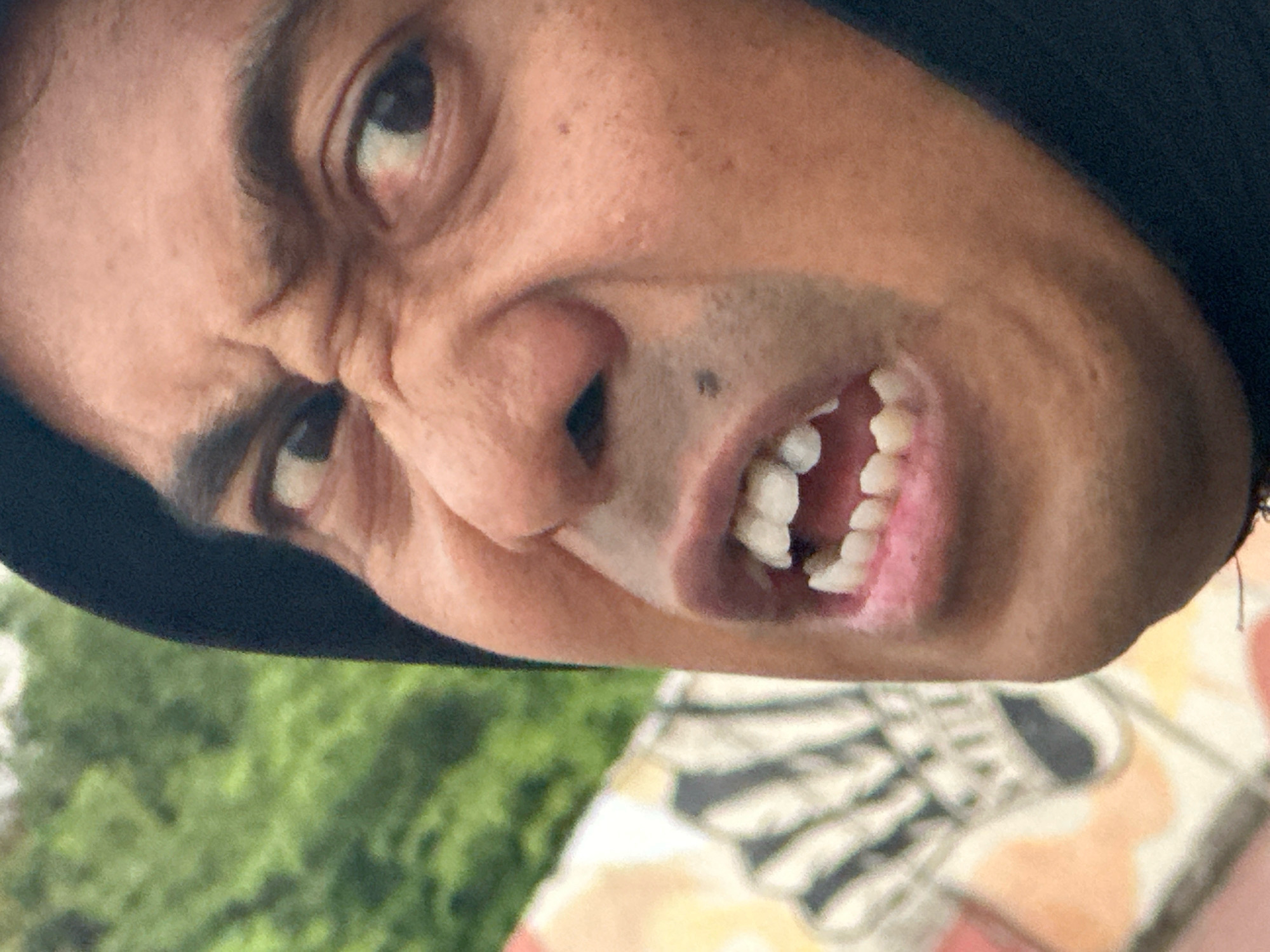 A close-up, low-angle, Dutch tilt shot shows the upper half of a person's face, angled upside down and to the right. The person, wearing a black hijab, grimaces with their mouth open, revealing several teeth. The skin is light-toned with visible pores and freckles, and the eyes are dark. The background is blurred, featuring green foliage and what appears to be a colorful, patterned surface, possibly a mural or tiled area. The image appears to have been taken outdoors in Mojokerto, Indonesia.