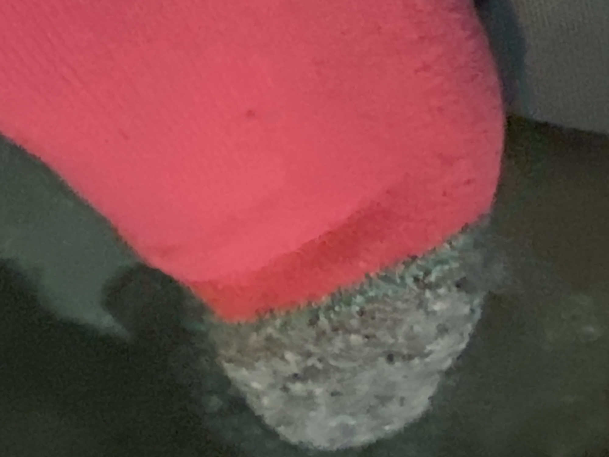 A close-up image shows a pink sock worn on a foot, with the toe area of the sock being speckled gray. The foot rests on a dark surface. The background is out of focus. There is no evidence to indicate this image was taken in Sochi, Russia.