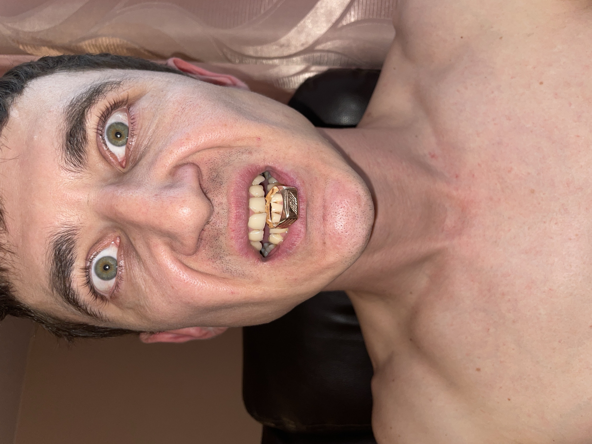 This media file shows a close-up, rotated, low-angle shot of a person's face and upper chest. The person, with fair skin, has light green eyes and dark eyebrows. They are wearing a gold grill on their lower teeth. The setting appears to be indoors, possibly a room with a textured curtain in the background and a dark surface, perhaps a sofa or chair, beneath them. The lighting is artificial, casting shadows and highlighting the texture of the skin. The person's expression is open-mouthed, revealing the grill, and their eyes are wide, suggesting a candid or posed moment. There is no visible text in the image. The location context provided is Laishevo, Russia.
