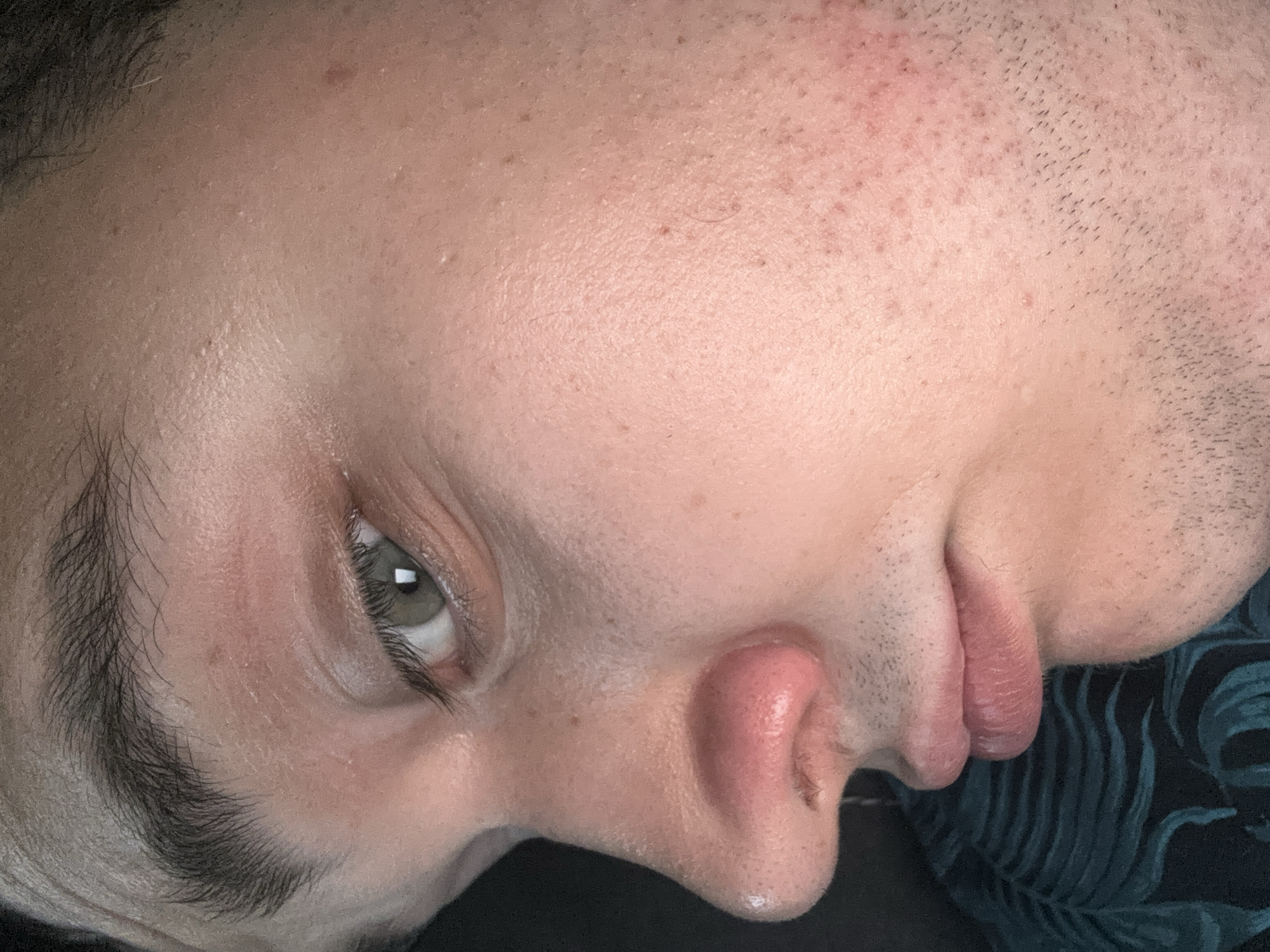 The image is a close-up, upside-down, low-angle shot of a person's face. The subject appears to be a young adult with fair skin. Visible features include a portion of the left eye, the nose, and the lips, as well as parts of the forehead and cheek. The skin shows some texture, with visible pores and a few small blemishes or possibly milia. There are also some darker, short hairs, indicating stubble or fine facial hair, particularly on the right side of the face. The eyebrows are dark and somewhat bushy. The lips appear full and slightly dry, with some visible texture.
The lighting is soft and diffused, suggesting an indoor setting or an overcast day. There are no explicit cues for time of day, weather, or a specific location. The background is blurred and dark, with a hint of a pattern that appears to be tropical leaves in dark green and black. No text is visible in the image. The focus is entirely on the facial features, and the close cropping suggests an introspective or artistic approach to the subject. The overall mood is neutral, with no strong emotional expression evident.