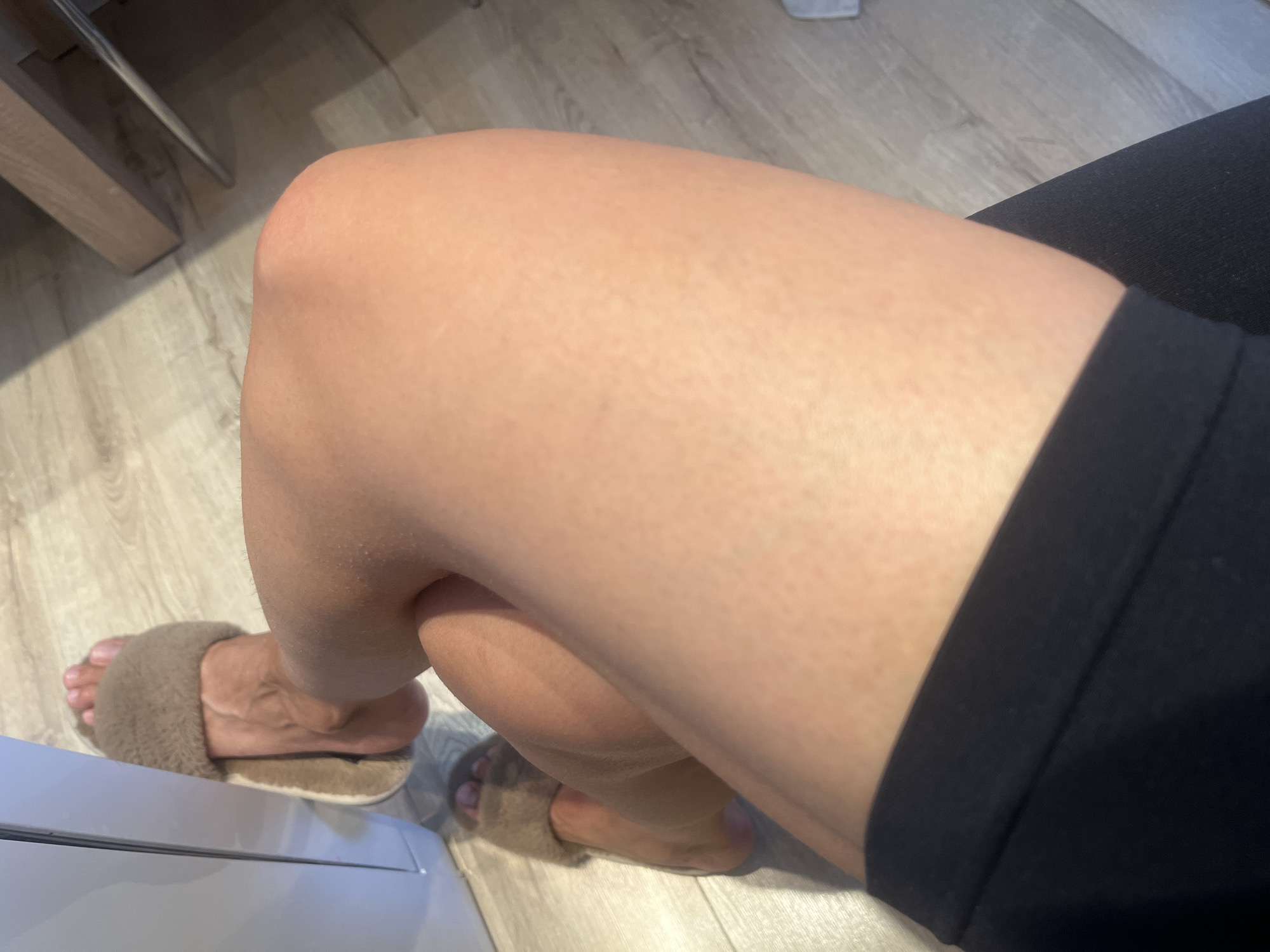 The image shows a close-up of a person's legs and feet, wearing fuzzy slippers. The person is sitting down, with their legs crossed. The flooring appears to be made of light-colored wood planks. A portion of a black garment is visible on the right side of the frame. The scene is indoors, and the lighting suggests it could be daytime, though no windows or external light sources are visible. There is no visible text in the image. The focus is on the lower half of the person's body, highlighting the texture of their skin and the slippers. The overall mood is casual and relaxed, likely within a home setting.