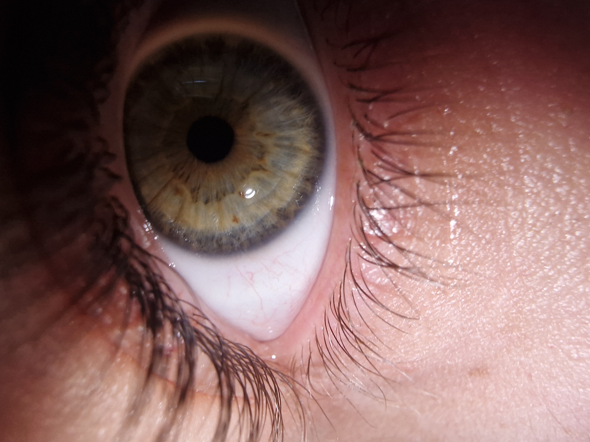The image depicts a close-up view of a human eye. The iris is a mix of green, grey, and brown tones. The pupil is black and centered. The sclera is white with visible blood vessels. The eyelashes are dark and surround the eye. The surrounding skin is light-toned with visible pores. The location is unknown.