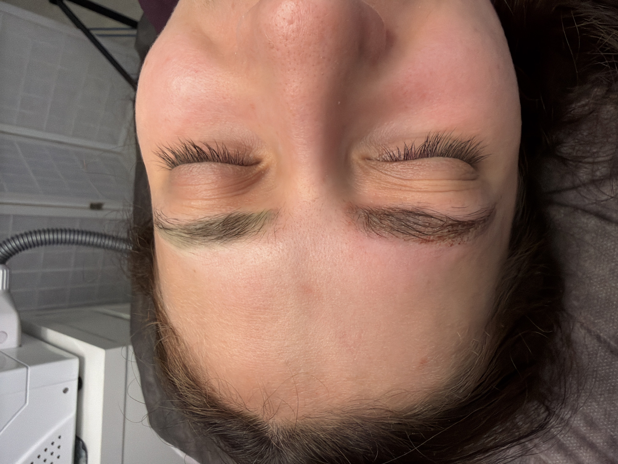 A close-up, angled overhead shot depicts a woman lying down with her eyes closed. Her skin is fair, and her dark hair is visible around her face. A portion of what appears to be medical or cosmetic equipment is visible in the lower left of the frame. Given the focus on the woman's face and the presence of equipment, it is possible that this photo was taken at a beauty salon or clinic. However, without additional information or context, I cannot confirm that this image depicts a scene in Riga, Latvia.