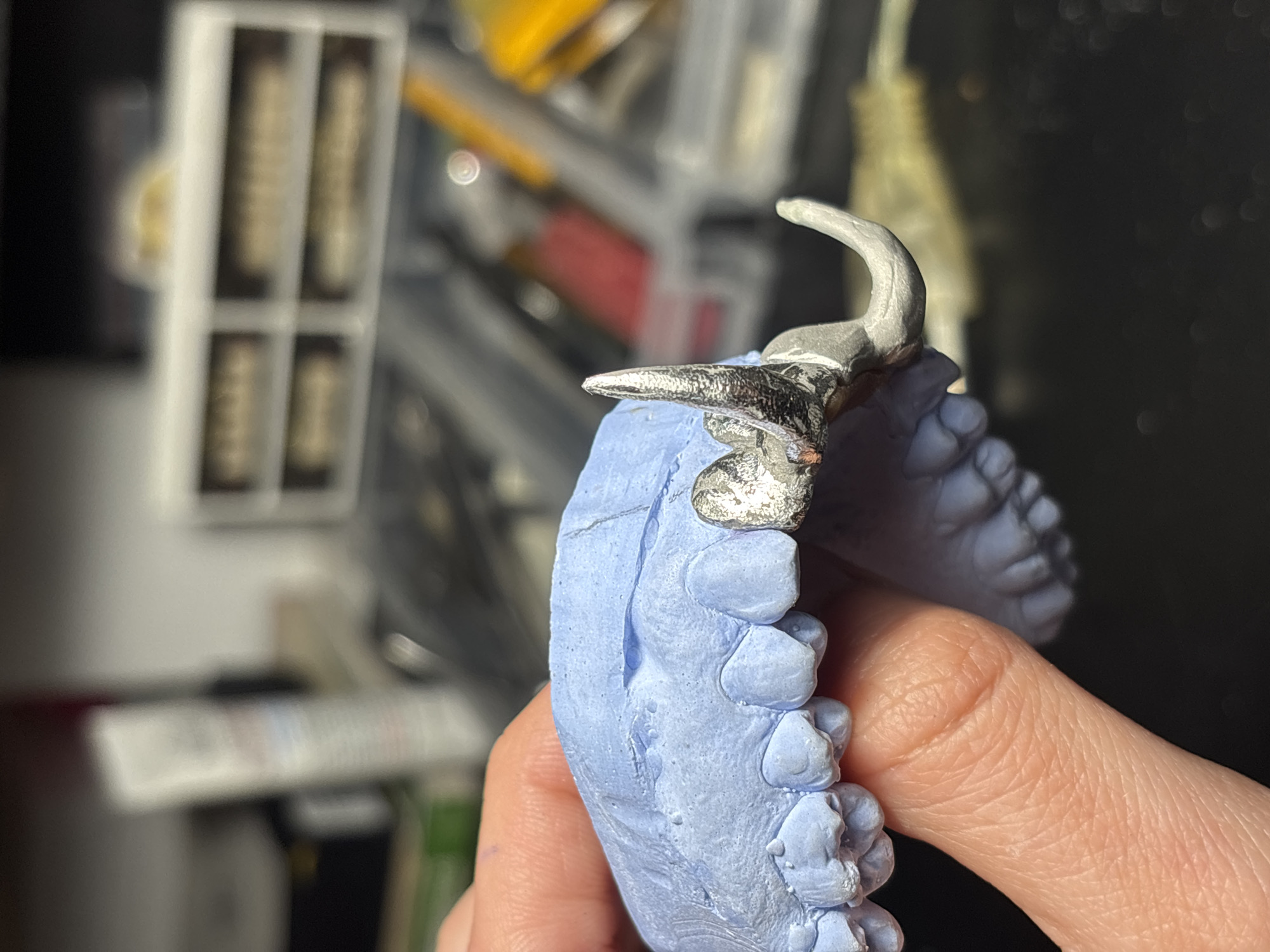 A human hand holds a blue dental cast model with a metal dental framework affixed to it. The metal framework has a clasp extending outwards. The background is cluttered with dental equipment and supplies. The location is likely a dental laboratory, but there is no definitive information to confirm it is in Sofia, Bulgaria.