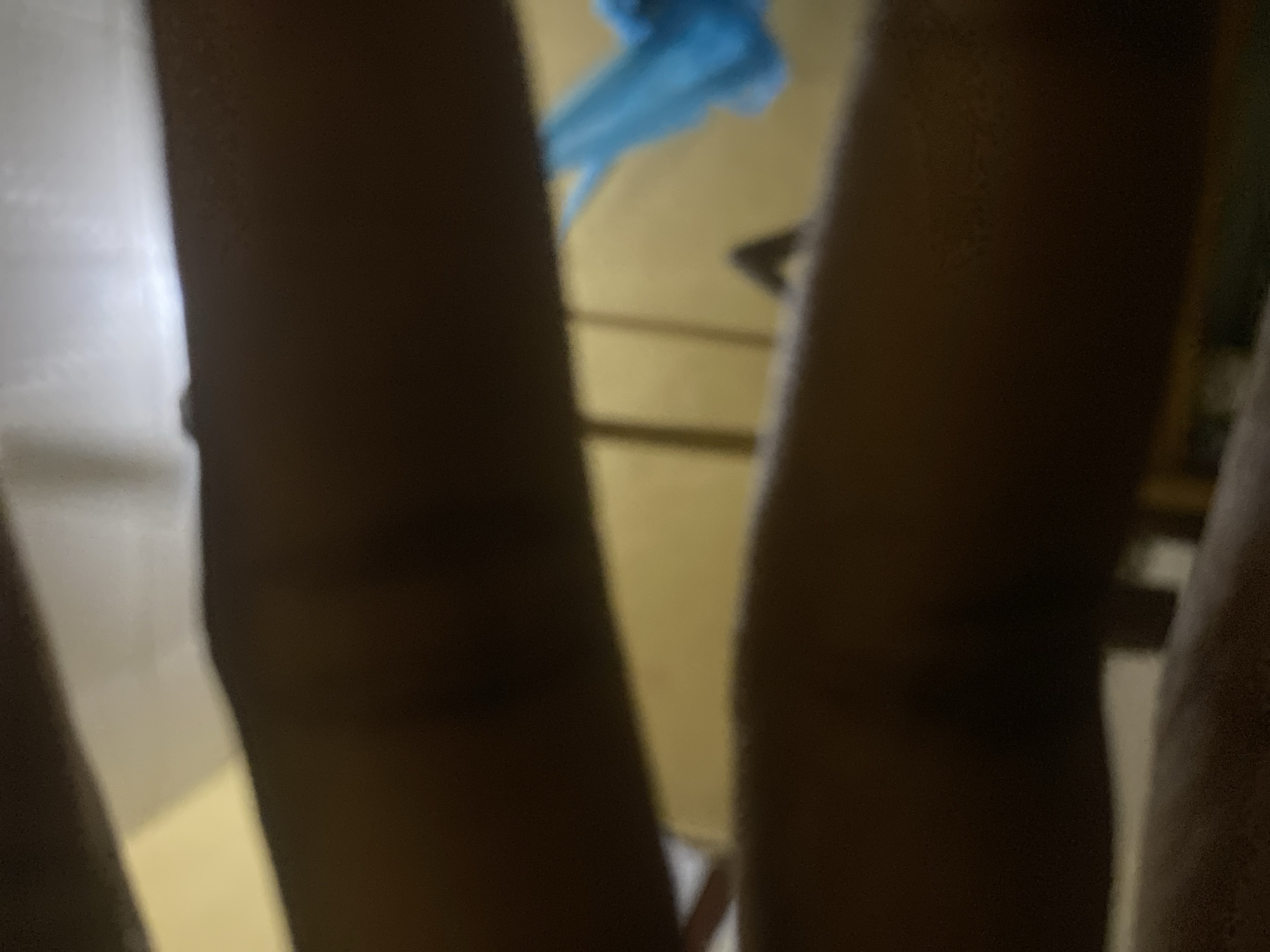 The image is a close-up shot of a person's dark skin legs. The background shows a wall and a blue object. It is difficult to provide more detail about the location in Gombe, Nigeria without additional context or clearer features in the image.