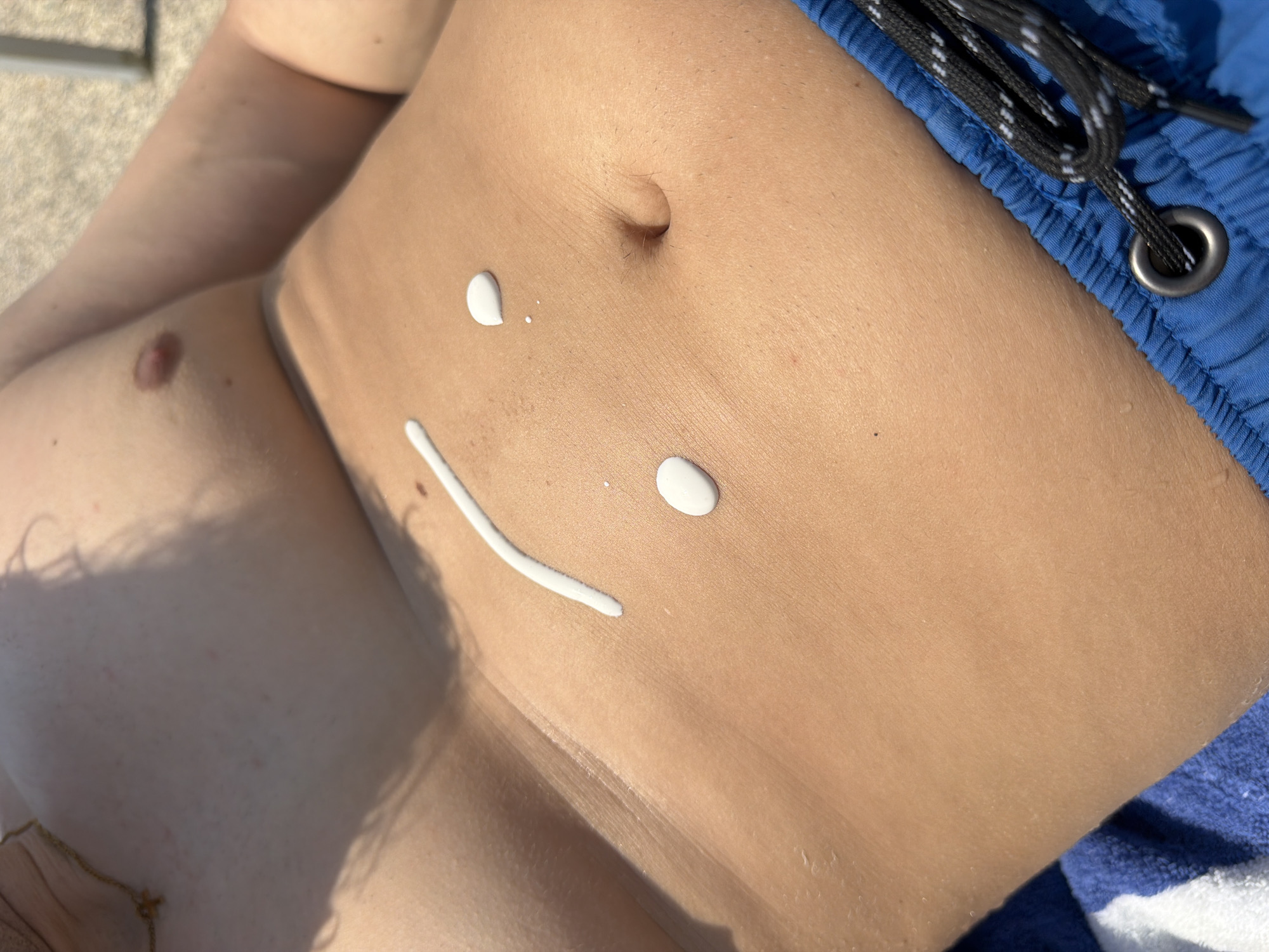 The image shows a close-up of a person's torso, lying down, with sunscreen drawn on their stomach in the shape of a smiley face. The person is wearing blue swim trunks with white drawstring details. The environment appears to be outdoors, possibly near water, as indicated by the bright lighting and the presence of a blue and white striped towel in the lower left corner. There are no specific landmarks in the image that would allow for precise identification of the location within Oroklini, Cyprus. The scene is static and focused on the detail of the sunscreen smiley face.