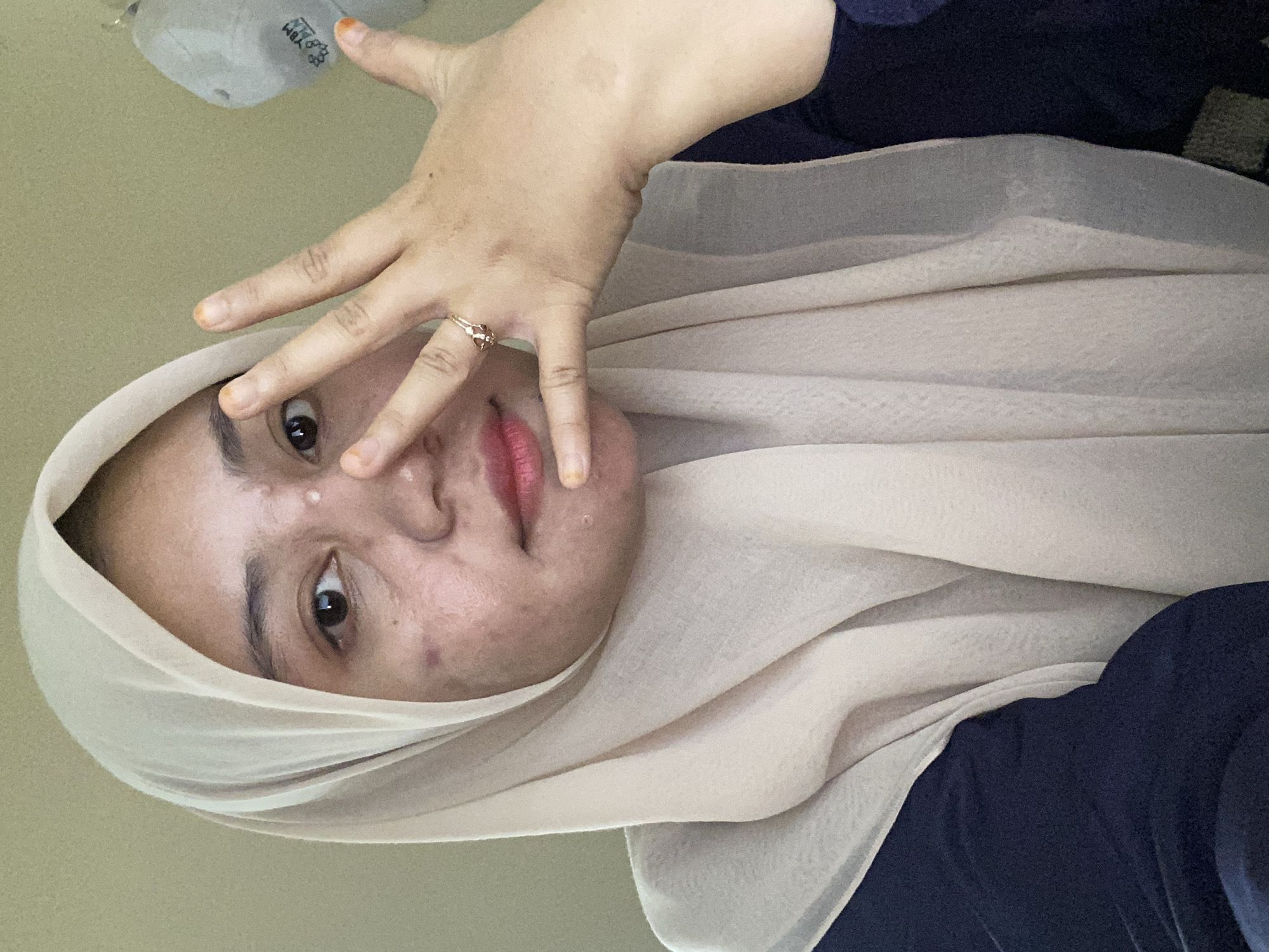 A young woman wearing a light-colored hijab and a dark blue top is captured in a close-up, self-taken photograph. Her right hand is raised to her face, with her fingers extended and covering part of her cheek and eye. She is wearing a ring on her left ring finger. The woman's face shows signs of acne. She appears to be indoors, with a plain wall in the background. The image is not specific enough to determine the exact location in Banjarbaru, Indonesia.