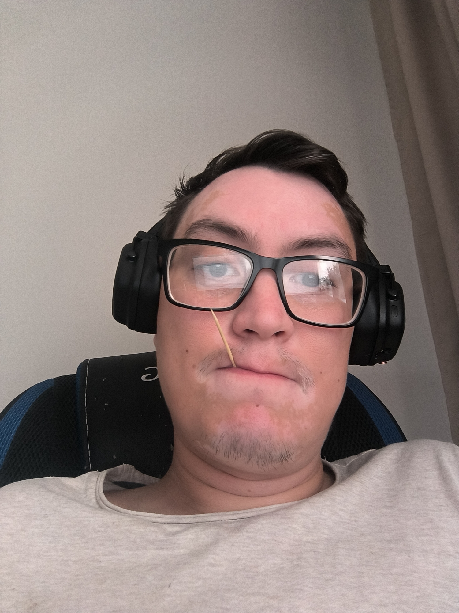 A close-up selfie shows a person wearing black over-ear headphones and black-rimmed glasses, with a toothpick extending from their mouth. The person has a light-colored t-shirt on and is seated in a chair with blue and black accents. Patches of lighter skin are visible on the person's face. The background consists of a plain, light-colored wall and a beige curtain. The image is framed from the chest up, with the person's head tilted slightly. There is no discernible location in the city of Kovrov, Russia, present in this image.
