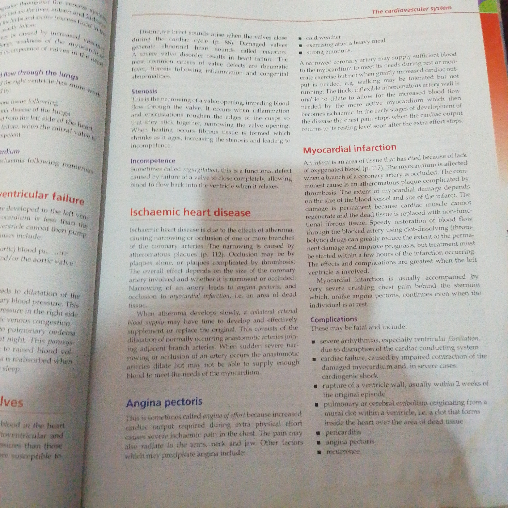 The image is a photograph of an open book displaying text and headings related to the cardiovascular system. The book is laid flat, suggesting it is being read or consulted. The page is a mix of dense paragraphs and bulleted lists, indicating it is an educational or informational text. The text discusses various aspects of heart health, including valve issues like stenosis and incompetence, ischaemic heart disease, myocardial infarction, and angina pectoris, along with their causes, symptoms, and complications.
The page is lit by an overhead light, casting subtle shadows and highlighting the texture of the paper. There are no people or objects other than the book itself visible in the frame. The setting appears to be a quiet, indoor environment, likely a study or library, conducive to reading and learning. The time of day and weather are not discernible from the image. The overall tone of the image is academic and informative.
Visible text includes headings such as "The cardiovascular system," "Myocardial infarction," "Ischaemic heart disease," "Angina pectoris," and "Complications." Numerous medical terms and explanations are present, suggesting the book is a textbook or reference material for a medical or biology-related subject. The specific location within Jalingo, Nigeria, cannot be determined from the visual information alone, as there are no location-specific cues.