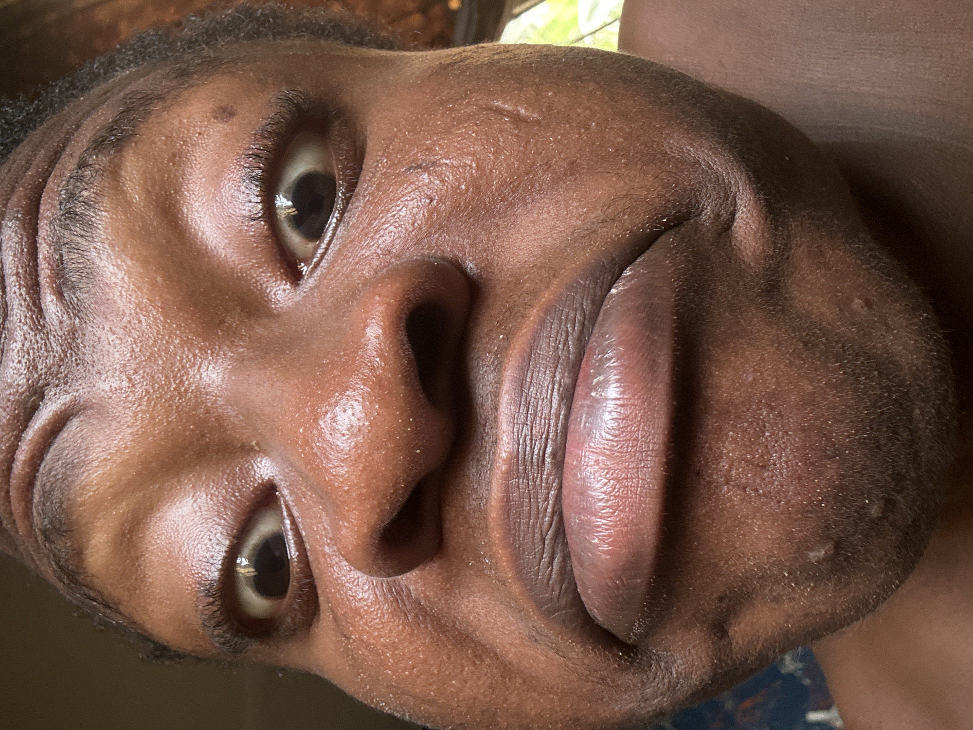 This is a very close-up portrait of a person with dark skin, positioned at a significant tilt. The subject's face occupies most of the frame, captured from a slightly upward and left-of-center angle, likely a selfie.
The person has wide, open eyes with dark irises, reflecting bright light sources in the pupils, suggesting well-lit conditions or an indoor setting near a window. Dark eyebrows and prominent eyelashes are visible. The nose is broad, and the lips are full and slightly parted, revealing the inner lower lip and creating an expression that appears engaged, possibly surprised, or with a slight smirk.
The dark-toned skin appears somewhat hydrated or oily, with visible pores, fine facial hairs, and minor textural irregularities such as small bumps or scars on the forehead, cheeks, and around the chin/mouth area. Short, dark, curly hair is visible along the top and side of the head.
The lighting is bright and direct, highlighting the forehead, nose bridge, and lips. The background is heavily blurred and indistinct, with a faint suggestion of green foliage and bright light in the upper right corner of the original image, implying an indoor environment adjacent to an outdoor view or strong light source. No visible text is present. The activity is the act of posing for or taking a close-up photograph.