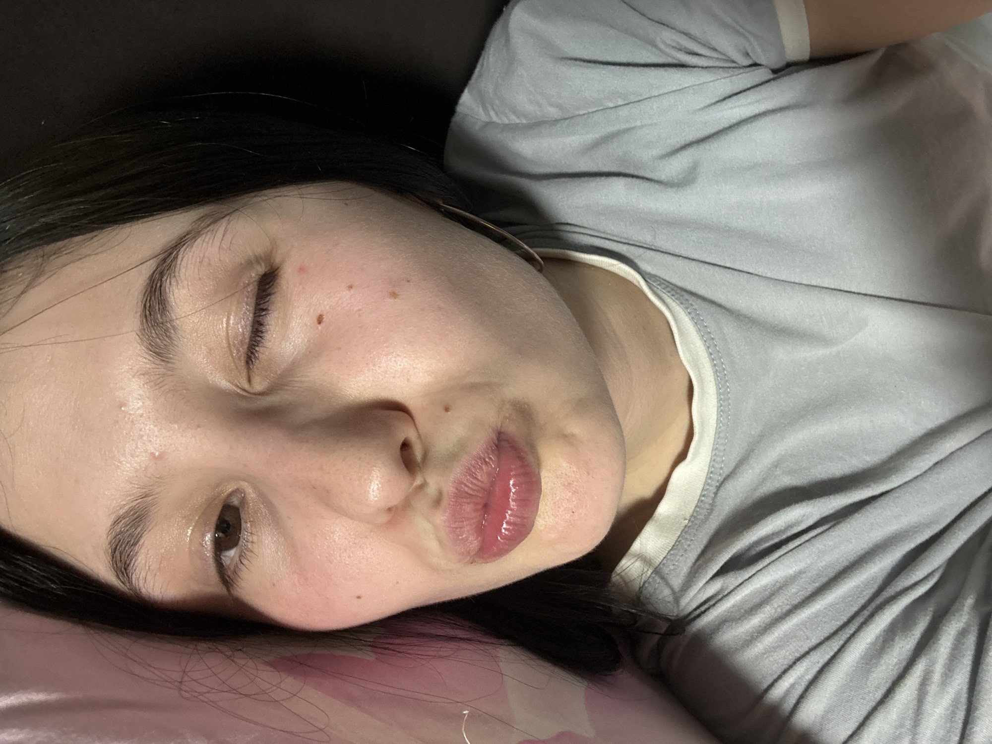 A young woman with long dark hair lies on a pink and white patterned pillow, wearing a grey t-shirt with a white trim. Her eyes are partially open, with one appearing more closed than the other. Her lips are pursed, and her skin is fair with a few visible moles and blemishes. Part of an earring is visible near her ear. The background is dark and out of focus. There is no evidence that indicates the image's origin is from Фоки, Russia.