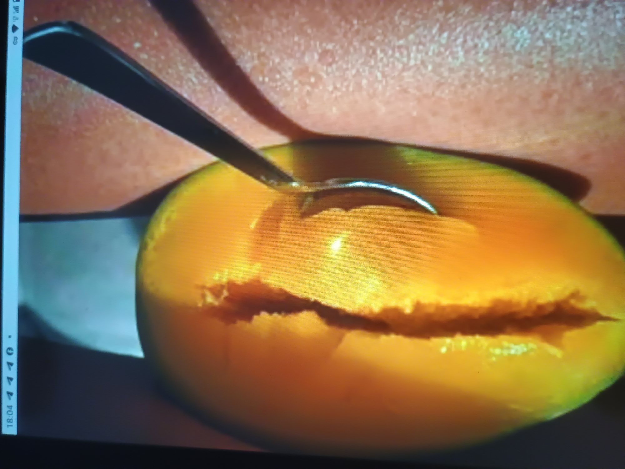 The image displays a close-up photograph of a digital screen, evident from the pixel grid and the status bar at the top showing "18:04" and various signal indicators. The primary subject is a large, vibrant yellow-orange fruit, likely a mango or papaya, cut lengthwise to reveal its interior. A silver spoon is partially inserted into the fruit's flesh, suggesting the act of scooping or consumption. The fruit exhibits a prominent, elongated central cavity where a seed or pit would reside. To the immediate right of the fruit, a section of light-toned human skin, possibly an arm or leg, is visible, showing a textured surface with discernible pores. The background to the left of the fruit is dark and indistinct, while the overall lighting is warm, illuminating the fruit's color. The exact location within the city of Unknown, Unknown, cannot be determined from the visual information.