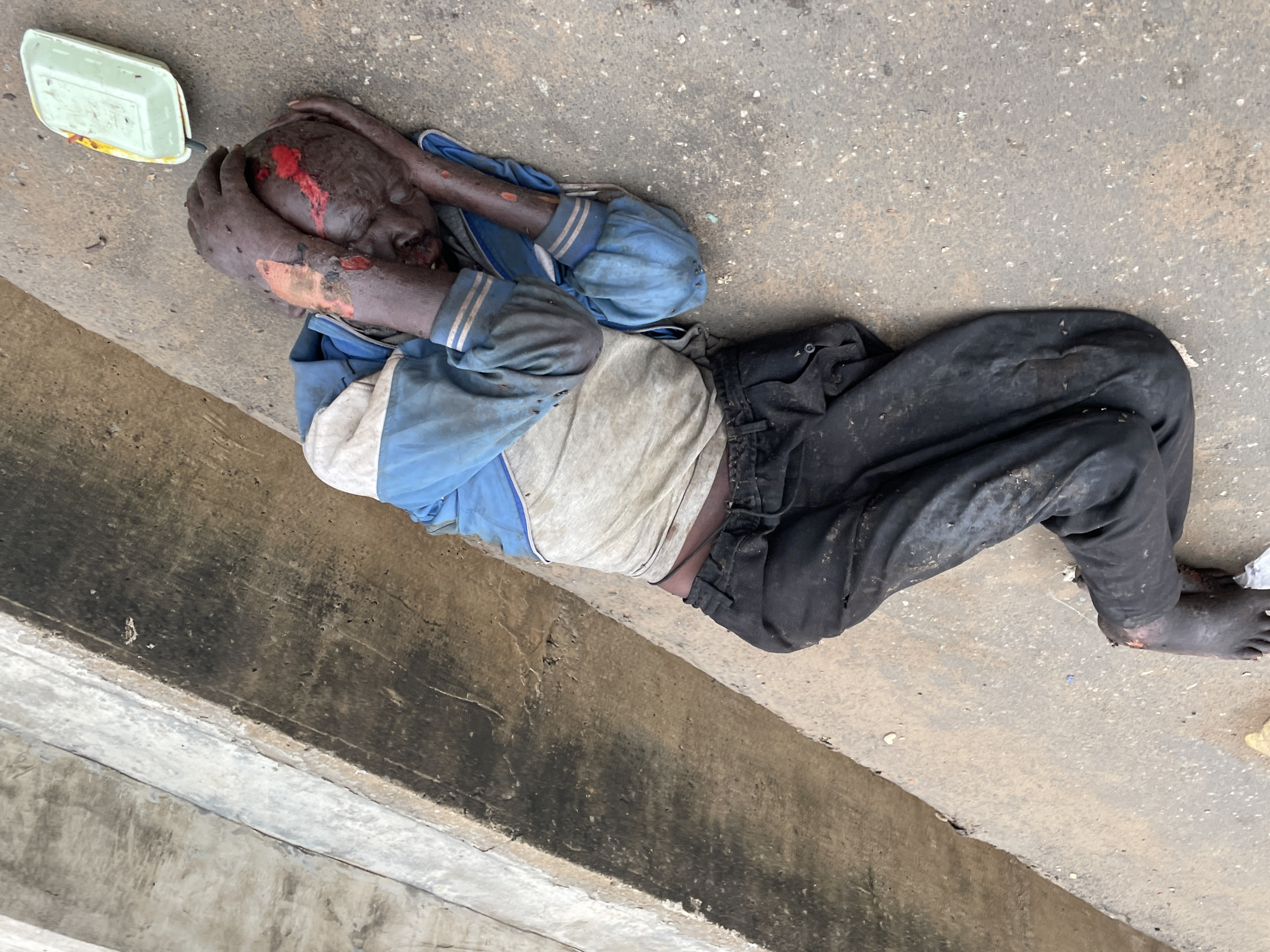 In Fegge, Nigeria, a young person lies on their side on a concrete surface, with a light green plastic container nearby. The individual is wearing a blue and white jacket, grey t-shirt, and dark trousers. Red and brown substances, possibly blood and dirt, are visible on their face, head, arms, and hands, with some appearing to be open wounds. Their head is resting on their hands, which are covering their face. The concrete surface shows signs of wear and discoloration, with some debris scattered around. The background includes a concrete structure with distinct steps.