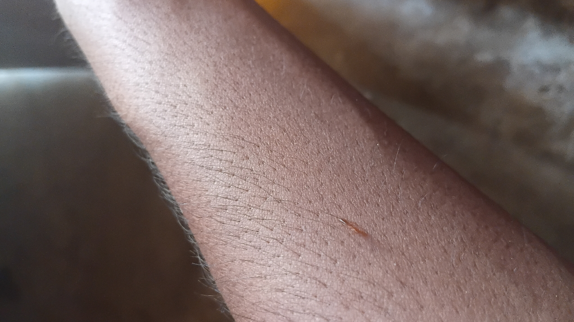 A close-up, eye-level shot shows a person's forearm with visible hair follicles and light skin. A small, light brown, splinter-like object is embedded in the skin. The background is out of focus, appearing as a blurred mix of brown and grey tones. The image is set in Prabumulih, Indonesia.