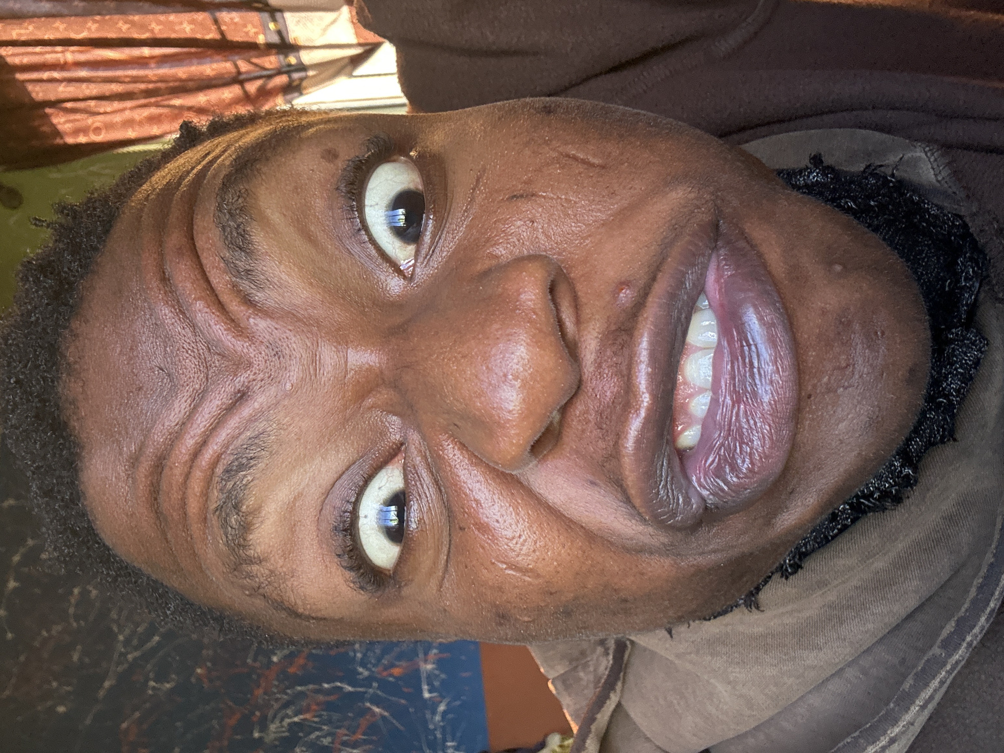 A close-up, slightly tilted portrait of a person with dark skin. The person has wide eyes and is smiling, showing their teeth. Visible facial features include wrinkles on the forehead, eyelashes, and lips. They are wearing a brown garment around their neck. The location in the city of Unknown, Unknown is not visible.