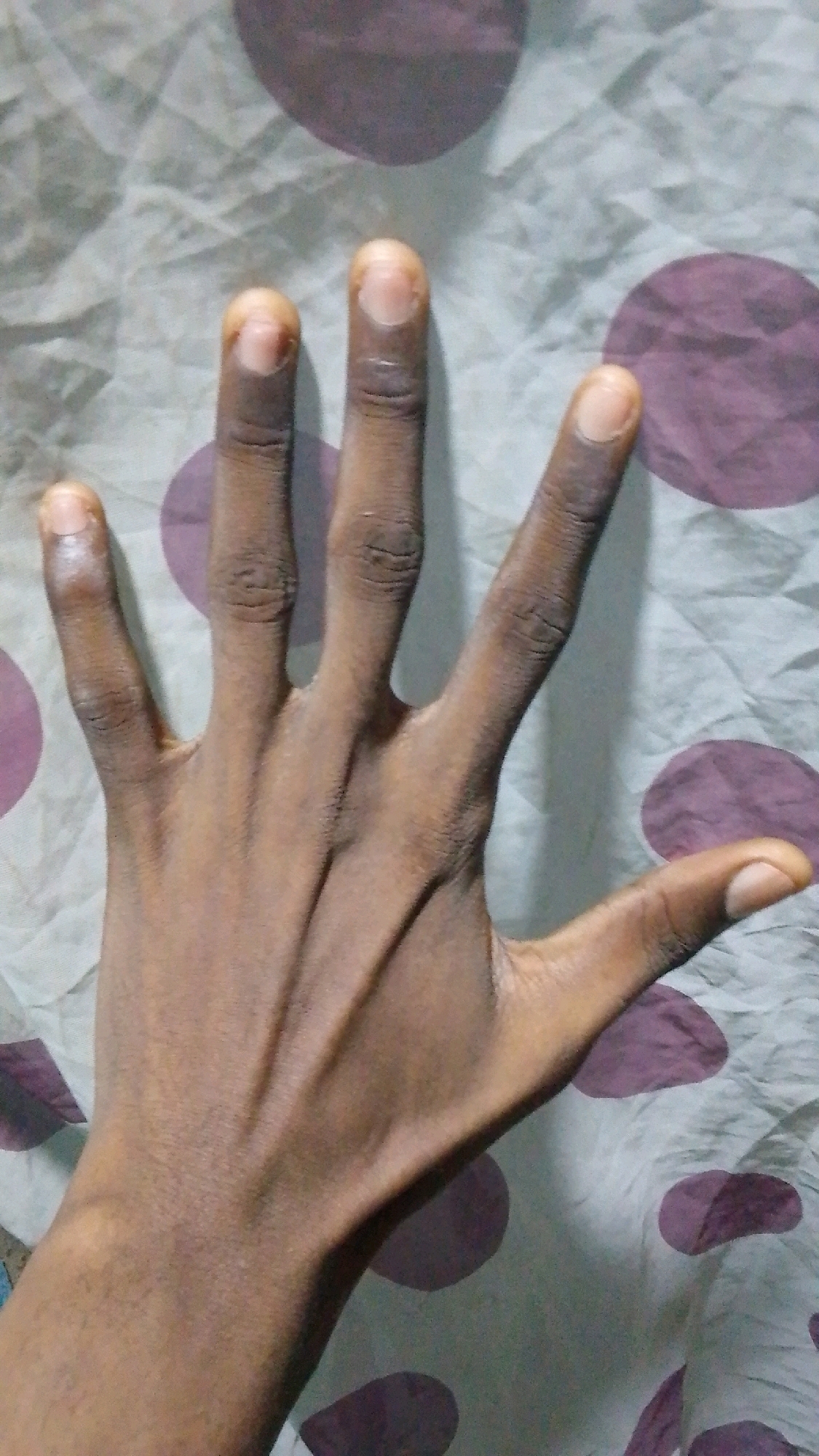A dark-skinned hand is shown from a top-down perspective against a light-colored fabric background with purple circular patterns. The hand is open with all five fingers extended upwards, and the palm facing the viewer. The fingers are slightly separated. The fingernails are visible and appear to be unpainted. The fabric background is textured and appears to be a bedsheet or tablecloth. There is no indication of the location being in Isolo, Nigeria; this is a general description of the hand and background.