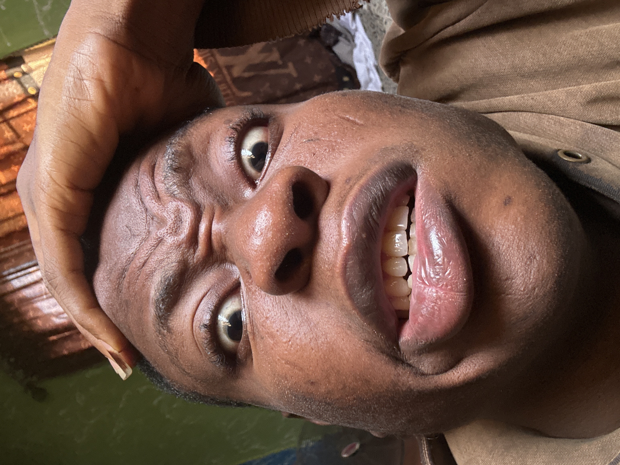 A close-up portrait of a dark-skinned person's face is presented at an unusual angle, with the camera positioned from below. The person is touching their forehead with their left hand. Their facial expression shows wrinkles, a furrowed brow, and slightly widened eyes, accompanied by an open mouth displaying teeth and tongue. The individual is wearing a brown garment. The background features muted shades of green and brown. While the image details are clear, the location in Ikorodu, Nigeria, is not evident from the image itself.