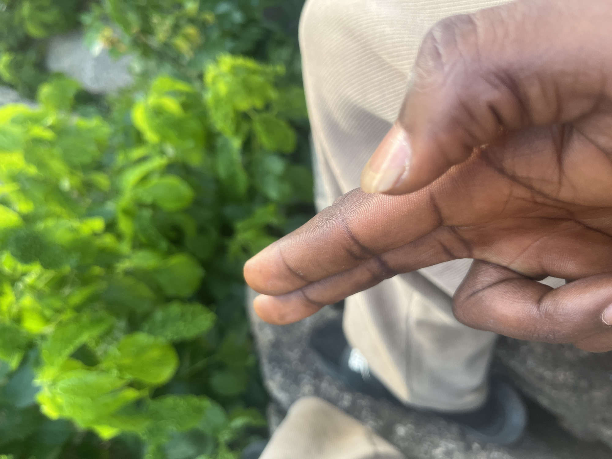The image displays a close-up, high-angle view of a human right hand in an outdoor setting within Barakin Akawo, Nigeria. The hand, exhibiting a dark skin tone, is positioned in the foreground with the index and middle fingers distinctly crossed, while the thumb is partially visible below them. The fingernails are short and clean. Below the hand, light-colored, likely beige, fabric consistent with trousers or other clothing is visible. To the left, a dark shoe or sandal rests on a blurred, dark grey surface, possibly concrete or rock. The background features heavily blurred, vibrant green foliage, indicating dense plant life and an outdoor environment under natural daylight.