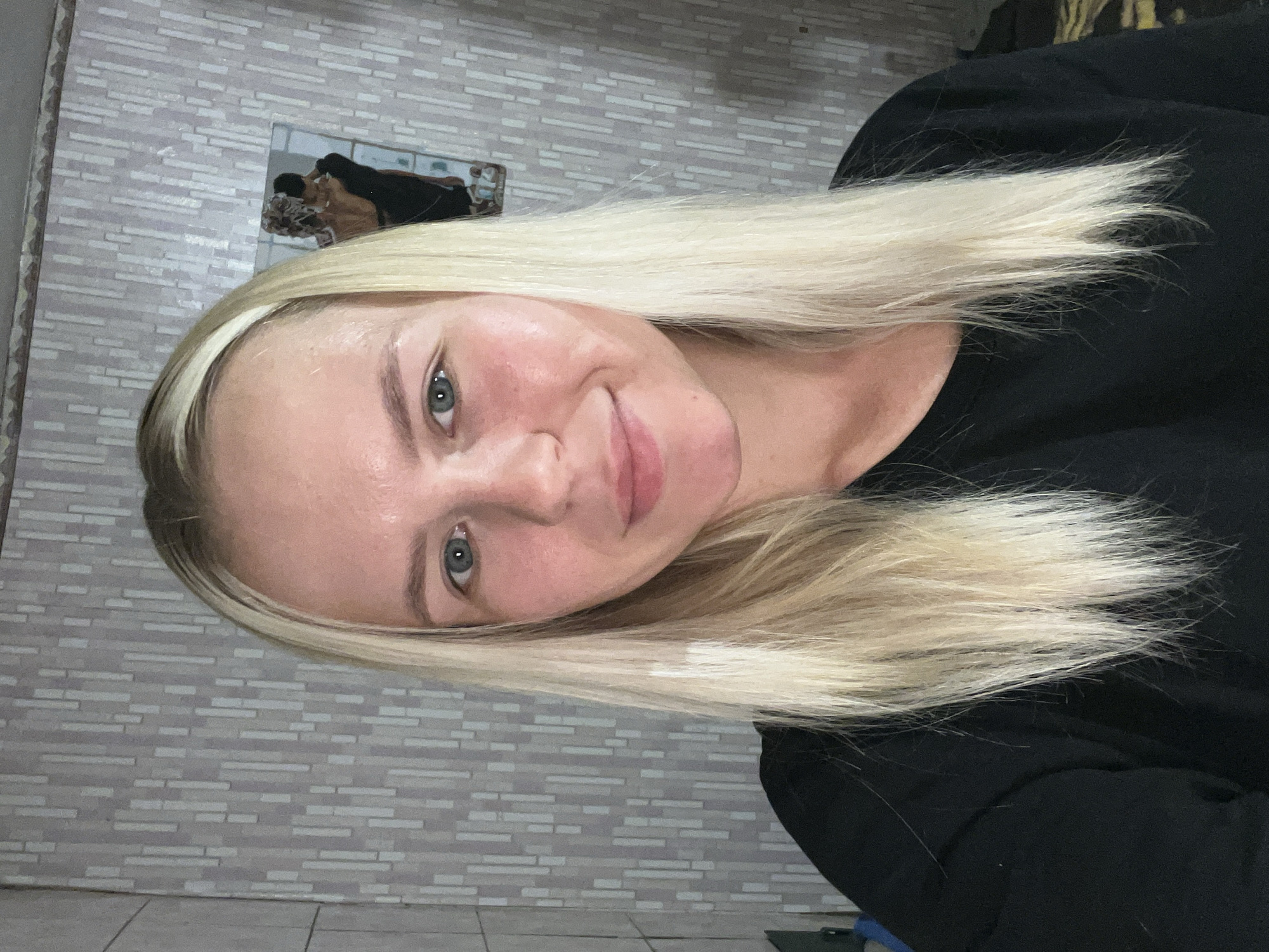An overhead, medium shot shows a young, white woman with long, blonde hair and blue eyes, looking into the camera. She has a slight smile and is wearing a black t-shirt. Her skin appears to have some redness, possibly from sun exposure or irritation. The background features a gray, vertical striped wallpaper and a small framed picture on the wall. The overall lighting is soft and even. The woman is positioned in the center of the frame, with her shoulders and upper chest visible.