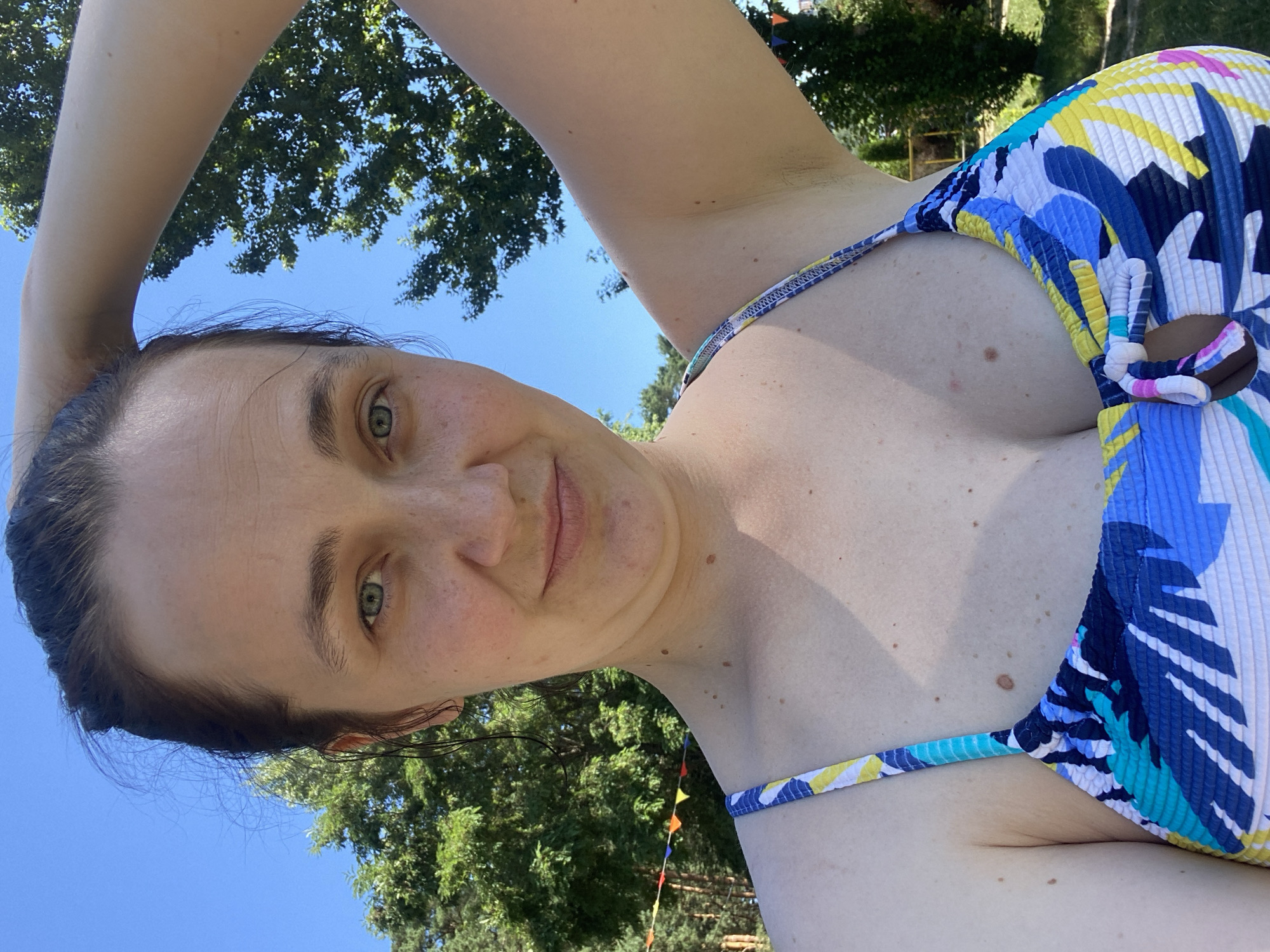 A woman with light skin and brown hair pulled back is taking a selfie outdoors. She is wearing a colorful swimsuit with a blue, yellow, and white tropical print. The woman has green eyes and is looking at the camera, with her right arm raised and hand resting on her head. She has freckles and a few moles visible on her skin. In the background, there are green trees and a bright blue sky. There are also some colorful triangular flags strung between poles in the distance. The overall setting appears to be a park or an outdoor recreational area.