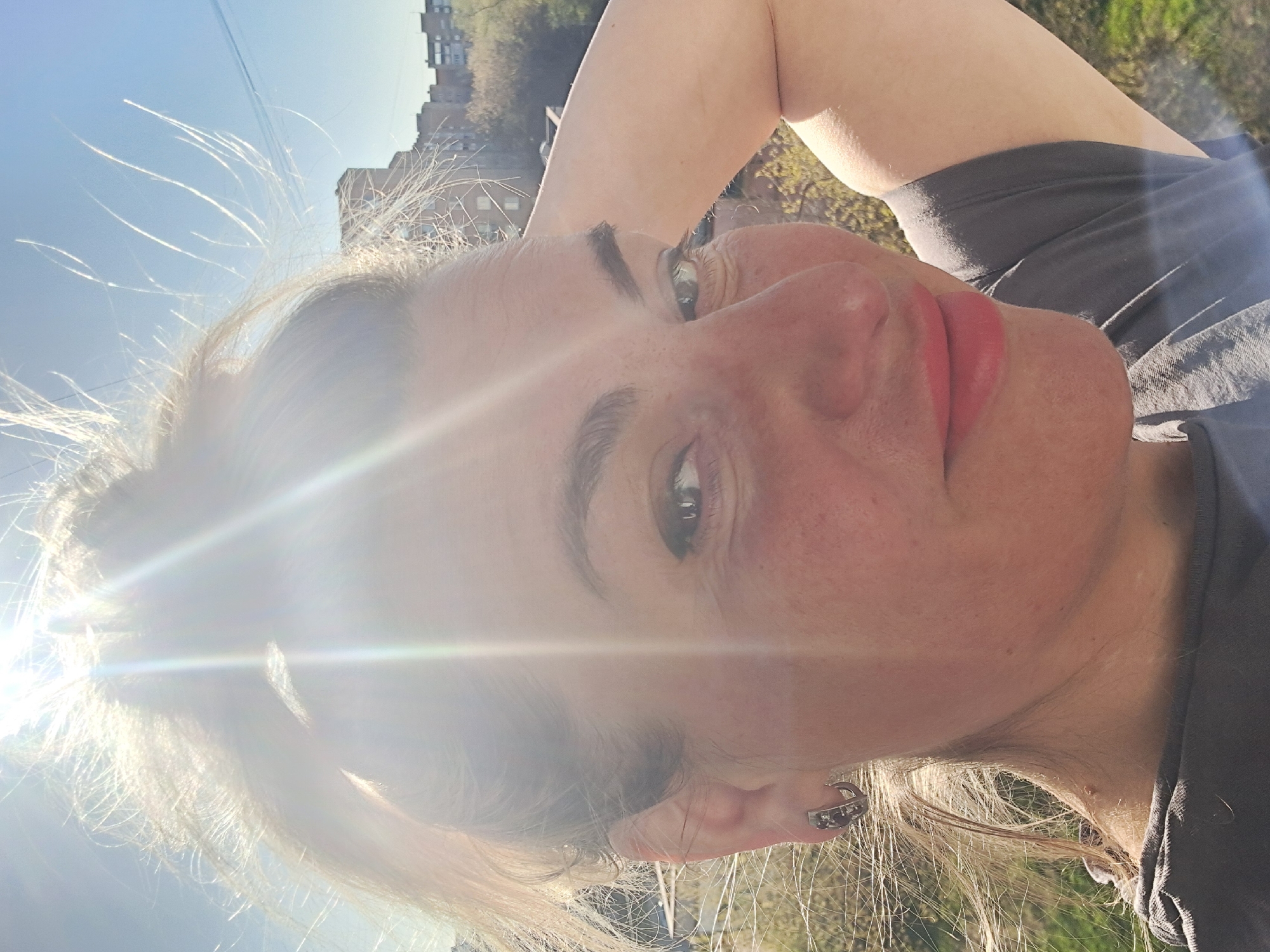 A fair-skinned woman is reclining outdoors, facing the camera at an approximate 45-degree angle. She has light-colored hair and is wearing red lipstick. Her right arm is raised behind her head. She is wearing a dark-colored shirt and earrings. The background shows trees, grass, and buildings under a bright, sunny sky. The location is not discernable as Elektrostal, Russia, from the available visual information.