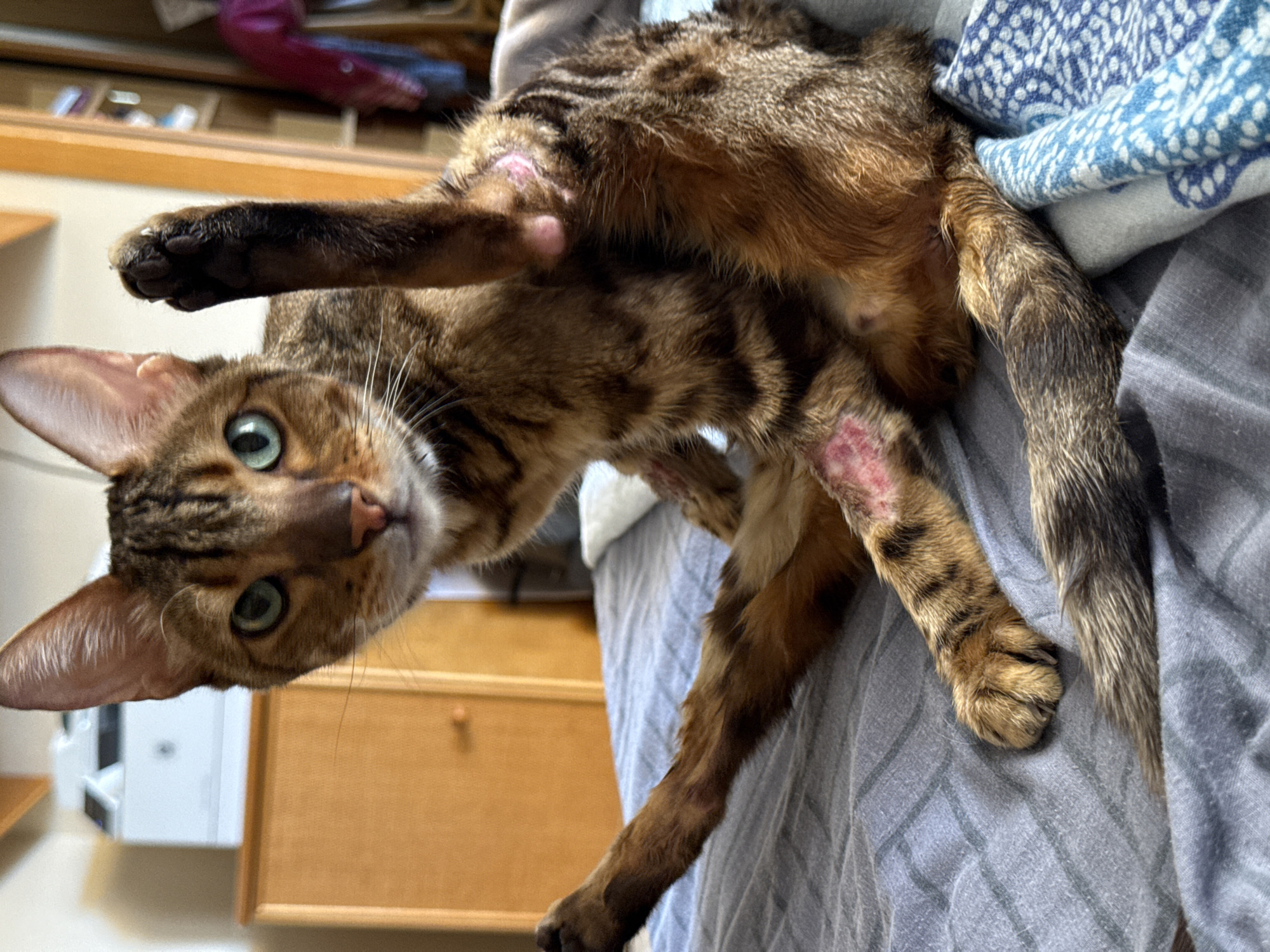 A short-haired tabby cat with green eyes sits on a bed with its legs splayed out. The cat's left front paw is raised in the air. The cat has some pinkish-red lesions on its hind legs and abdomen. The bed is covered with a gray striped sheet and a blue and white patterned blanket. In the background, there is a wooden dresser and a white printer. The location is not ascertainable from the image.