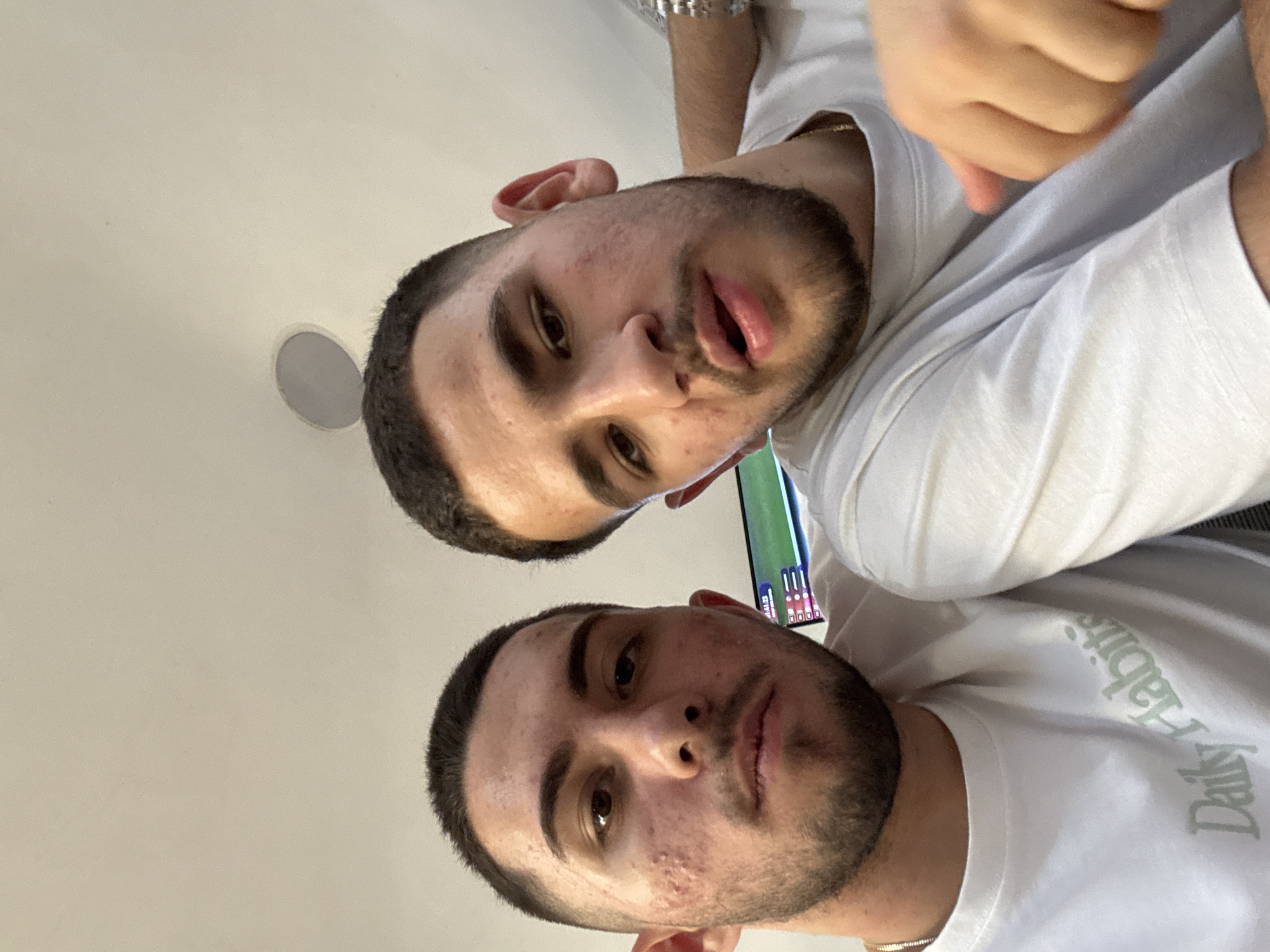 The image features two young adult males positioned closely together in an indoor setting, appearing to be a selfie-style photograph.
The male on the left has short, dark hair styled with a fade, and visible stubble on his chin and upper lip. He has prominent acne scarring and active blemishes across his cheeks and forehead. He is wearing a white crew-neck t-shirt with the text "Daily Habits" printed in a light green hue on the chest. A thin silver chain is visible around his neck. He looks directly at the camera with a neutral expression.
The male on the right also has short, dark hair and stubble, with some visible blemishes on his cheeks. He wears a plain white crew-neck t-shirt and a thin gold chain around his neck. His right arm, adorned with a silver-toned watch or bracelet, is placed behind the left subject's shoulder. His mouth is slightly open, and he appears to be looking slightly to the left of the camera.
The background consists of a plain, light-colored wall. In the upper right portion of the image, a circular, light gray ceiling speaker is partially visible. In the lower right background, a screen, possibly a television or monitor, is visible, displaying a predominantly green image with what appear to be on-screen graphics or data overlays, including numbers and bars.
The image does not contain any identifiable landmarks, signage, or other visual cues that would indicate its location in Blagoevgrad, Bulgaria, or any specific geographic region.