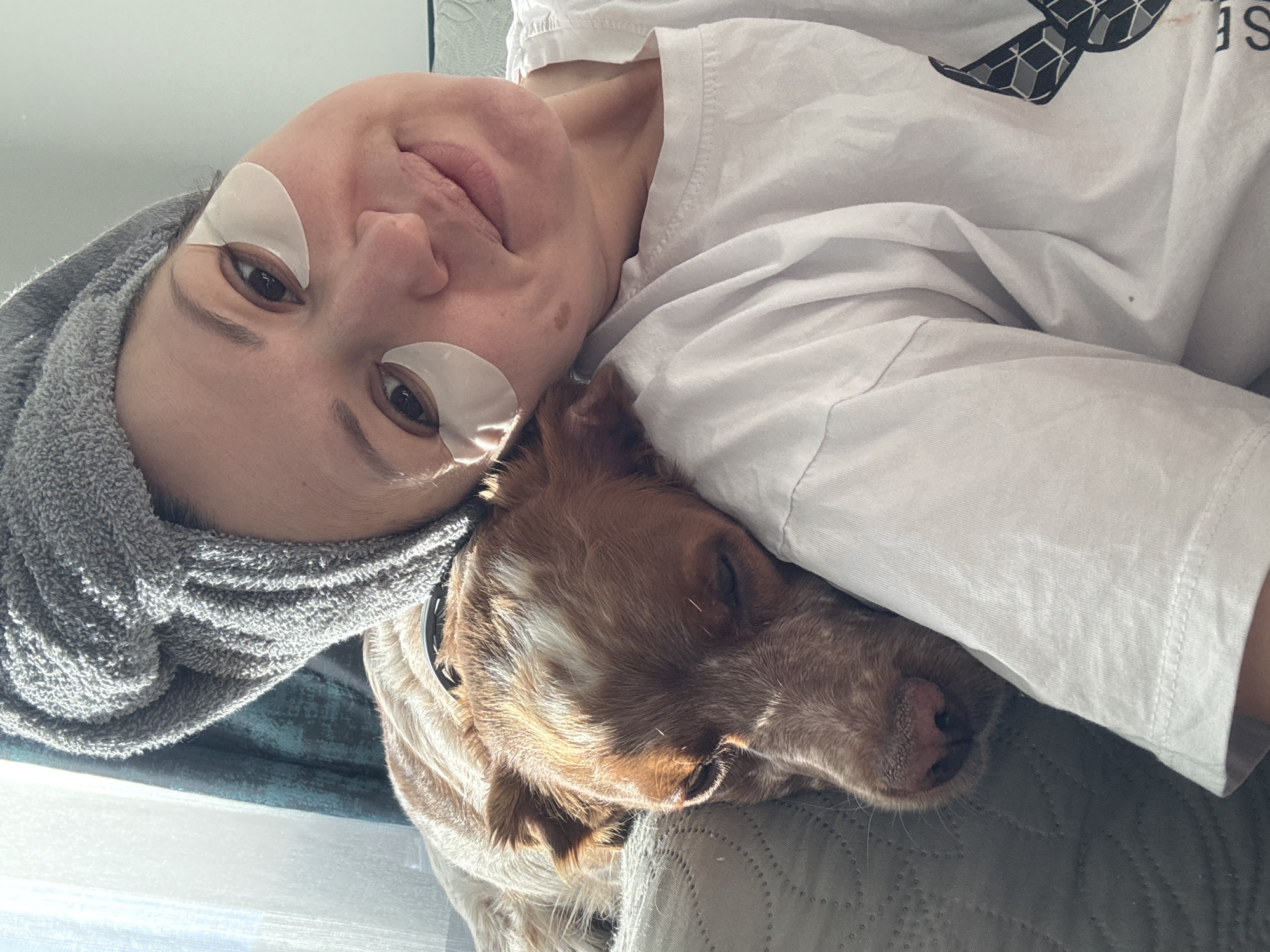 A woman with eye patches is lying next to a dog. The woman has a grey towel wrapped around her head and is wearing a white t-shirt. The dog is light brown with white spots and is wearing a black collar. The scene is indoors and the location is unspecified, therefore, Sofia, Bulgaria is not confirmed.
